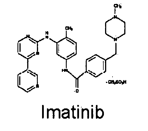 Method of treating inflammatory diseases using tyroskine kinase inhibitors