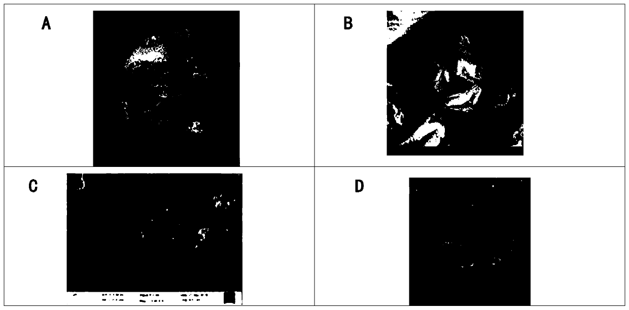 Glucan for preventing and treating hypertension and orally-taken yeast cell wall extract