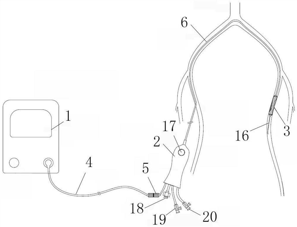 Vascular recanalization system and method for vascular stenosis lesion