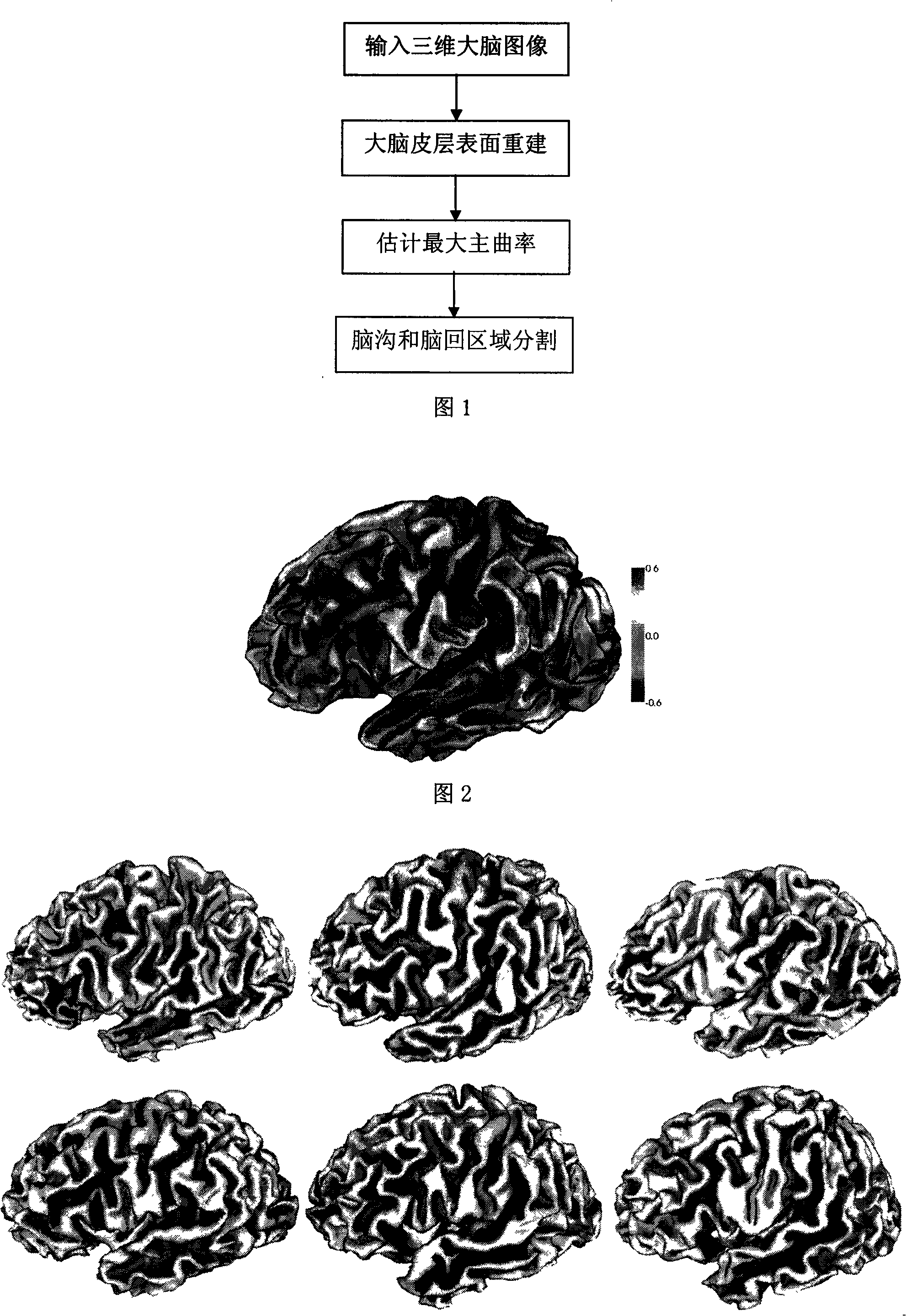 Method for segmenting sulus regions on surface of pallium of a three-dimensional cerebral magnetic resonance image