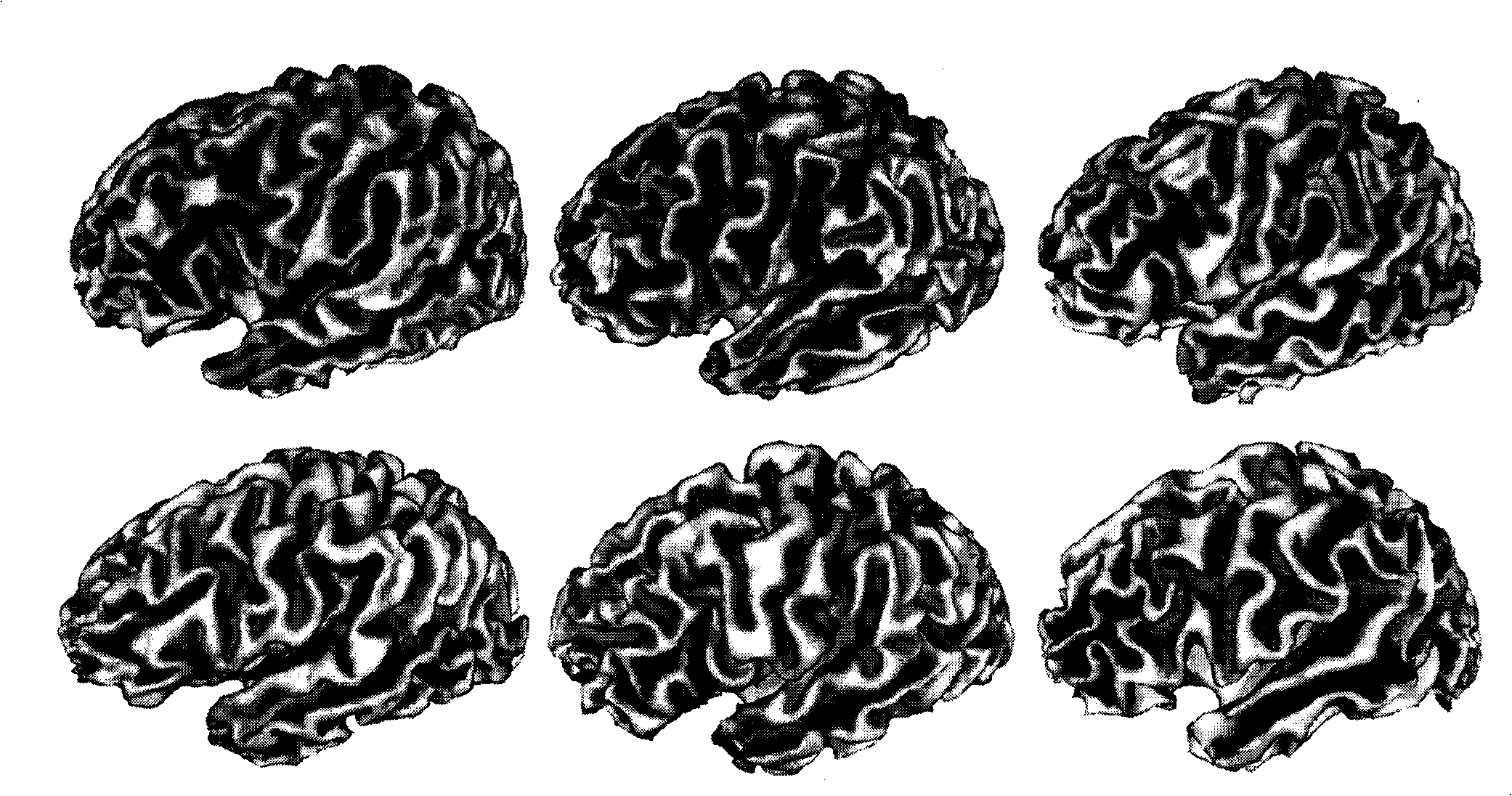 Method for segmenting sulus regions on surface of pallium of a three-dimensional cerebral magnetic resonance image