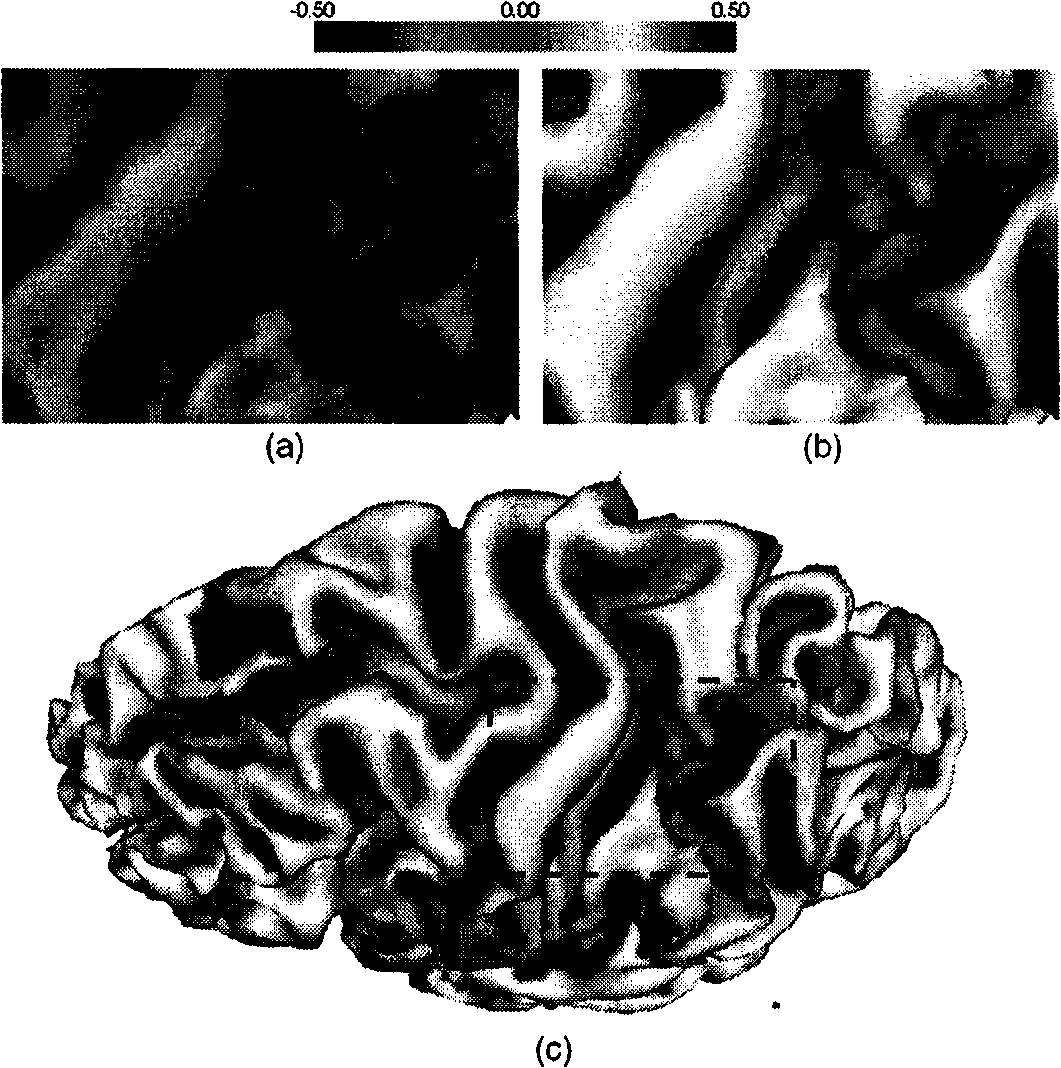 Method for segmenting sulus regions on surface of pallium of a three-dimensional cerebral magnetic resonance image