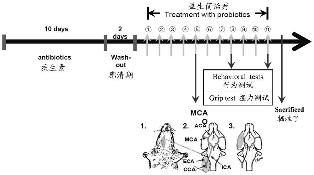 Composition for preventing stroke and improving stroke severity and application of composition