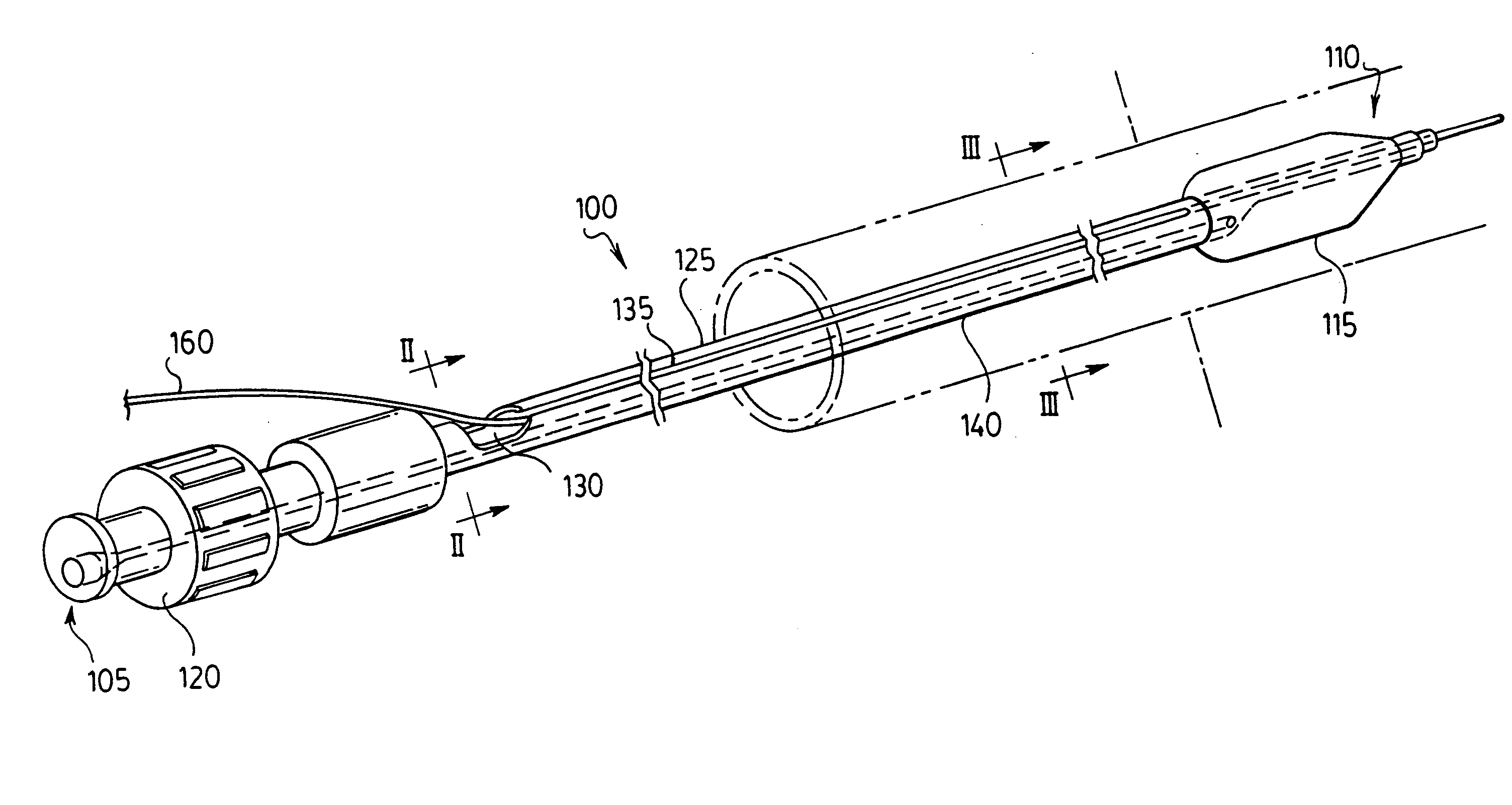 Stent delivery system and method of use