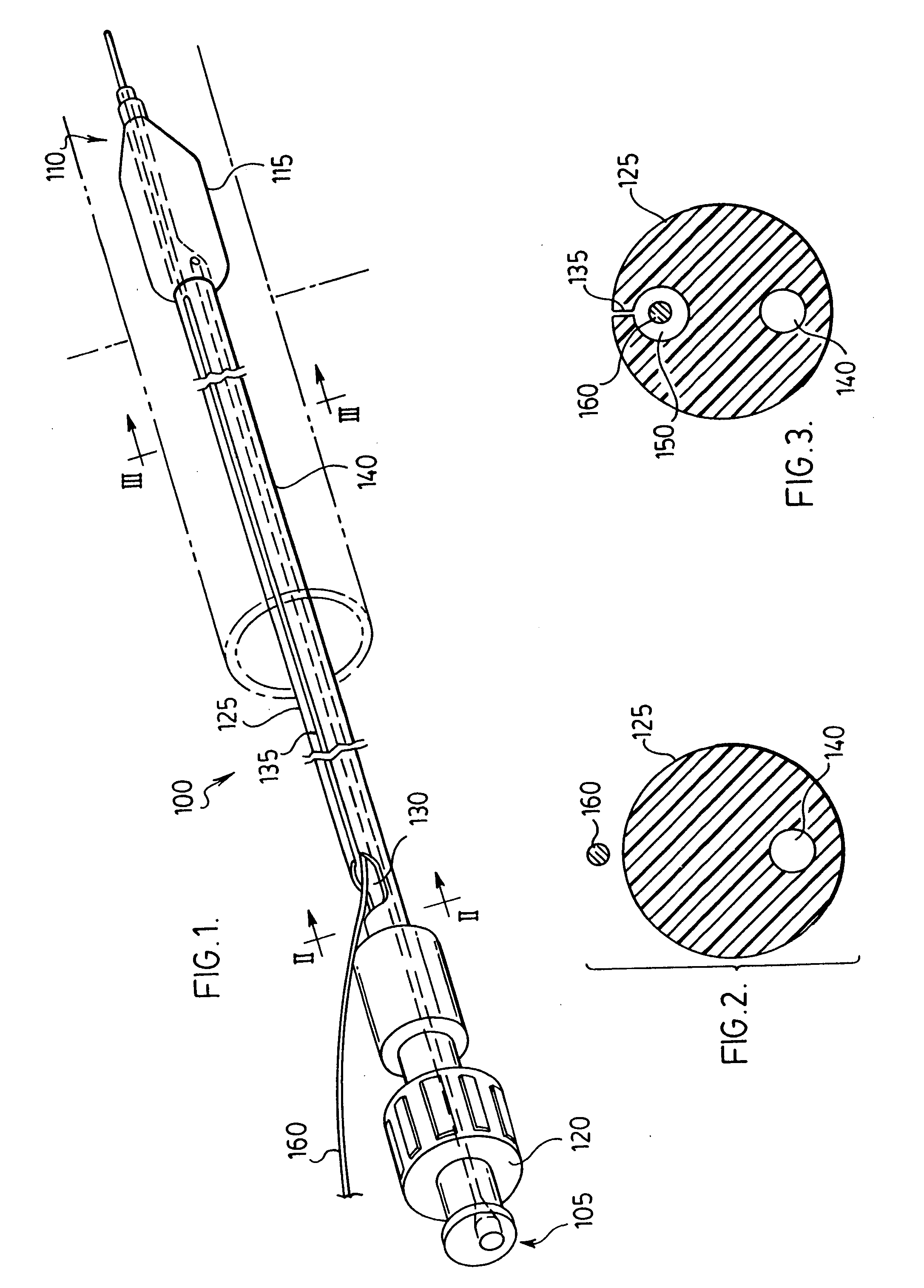 Stent delivery system and method of use