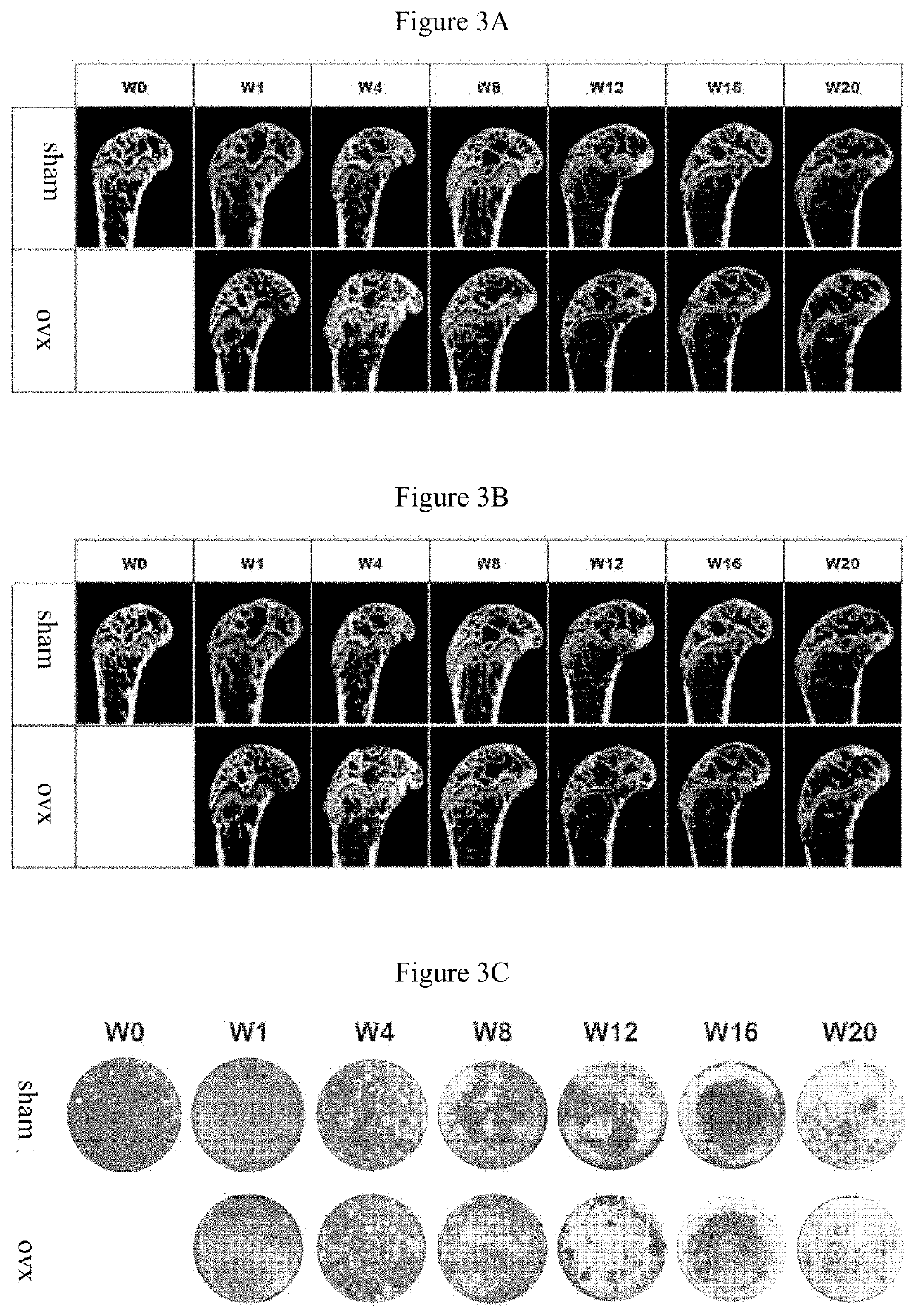 Mirna marker and kit associated with postmenopausal osteoporosis