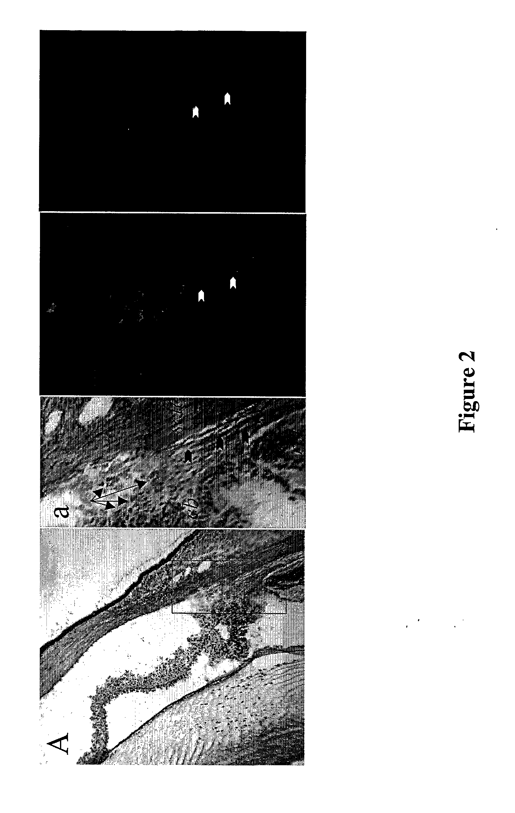 Methods And Devices For Delivering A Therapeutic Product To The Ocular Sphere Of A Subject