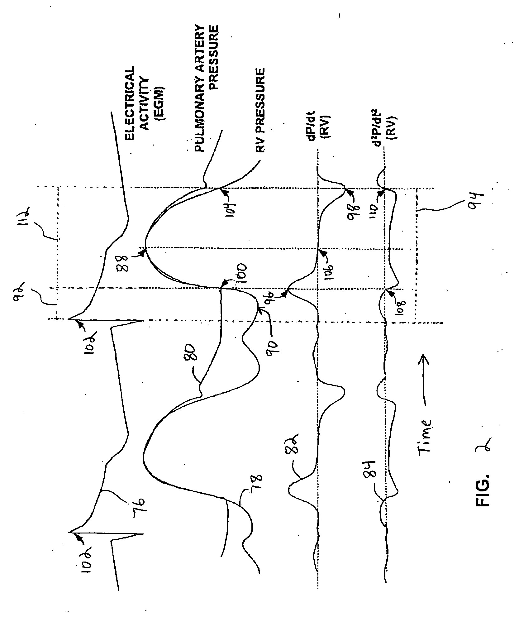 System and method for detecting artifactual hemodynamic waveform data