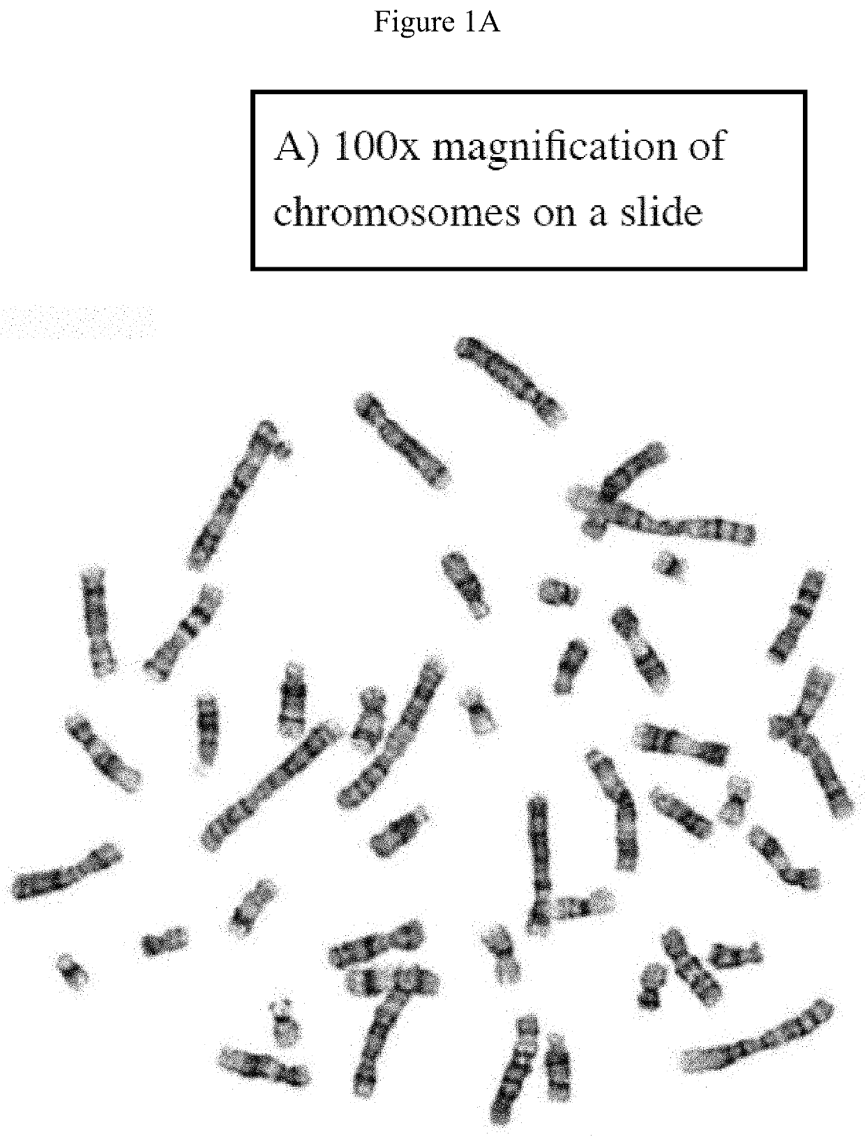 Chromosomal enhancement and automatic detection of chromosomal abnormalities using chromosomal ideograms