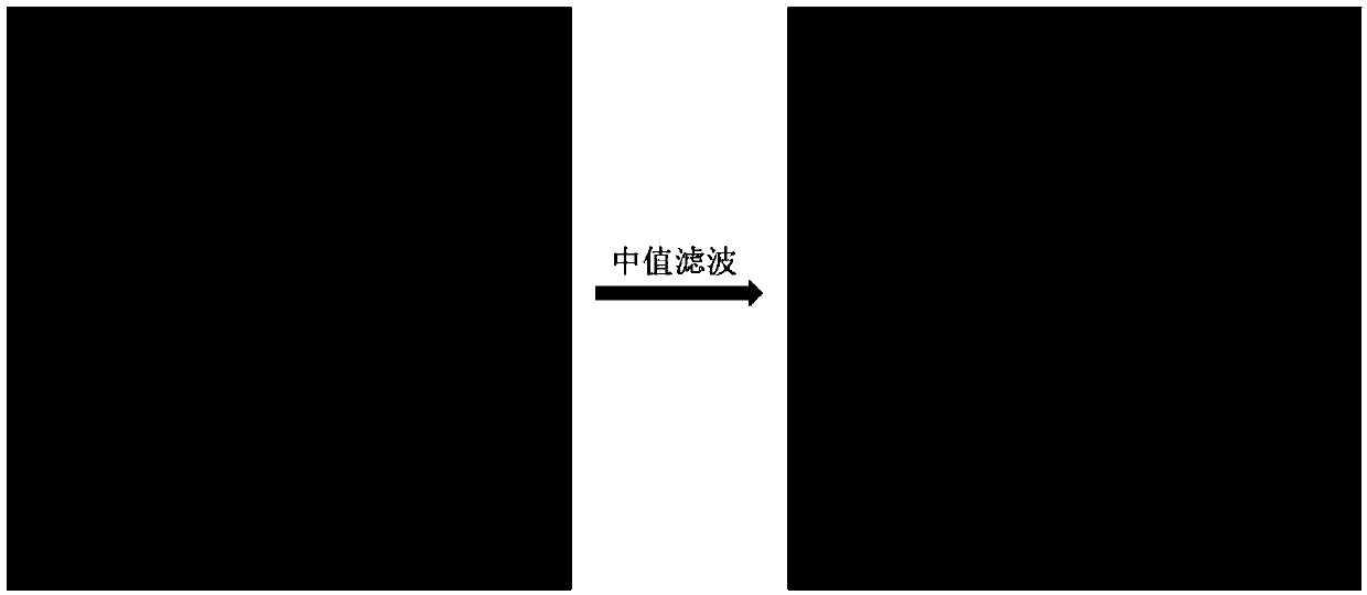 Method and device for detecting tumor cells in pleural fluid fluorescence image