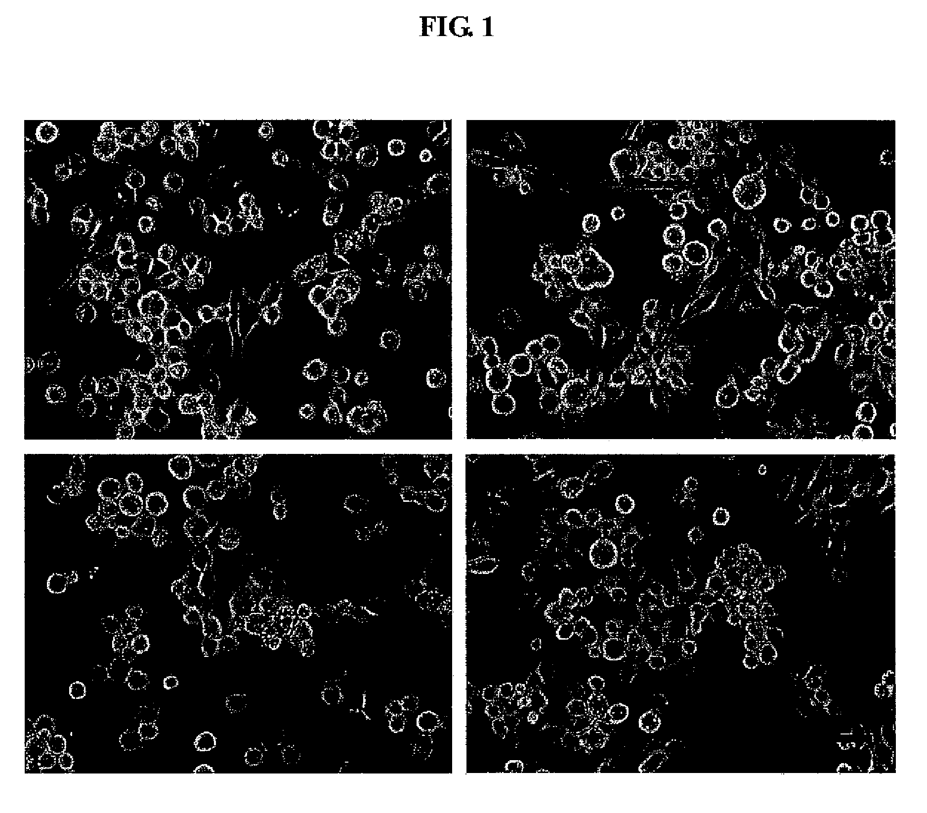 Established cell lines from Lymantria xylina