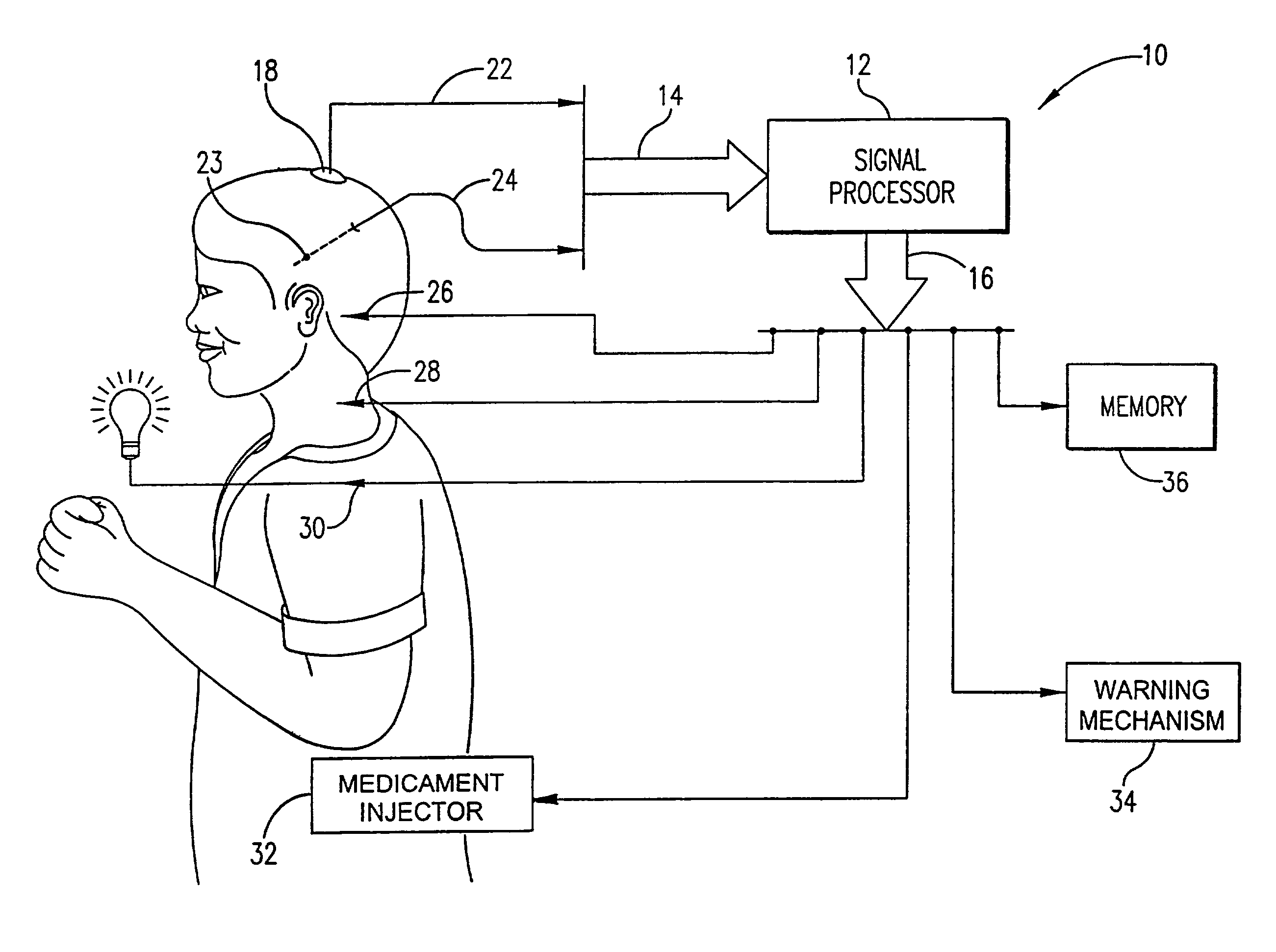 System for the prediction, rapid detection, warning, prevention, or control of changes in activity states in the brain of a subject