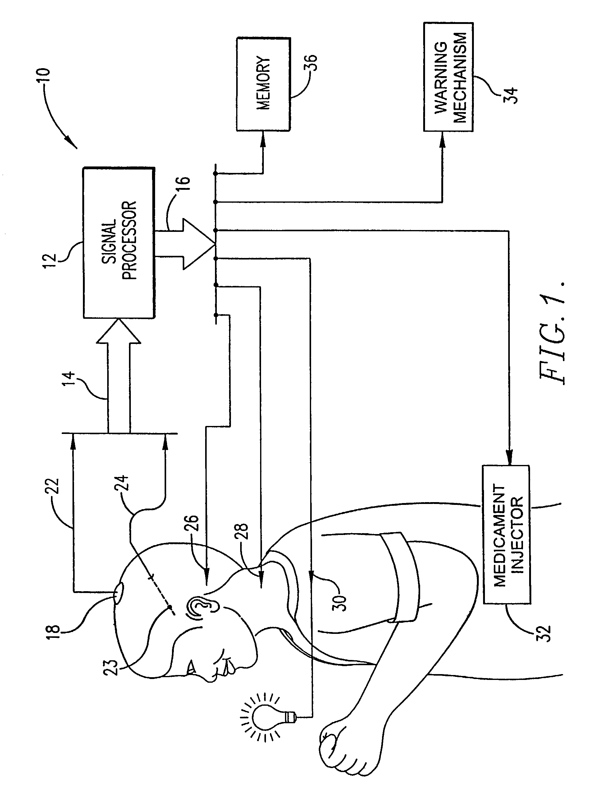 System for the prediction, rapid detection, warning, prevention, or control of changes in activity states in the brain of a subject