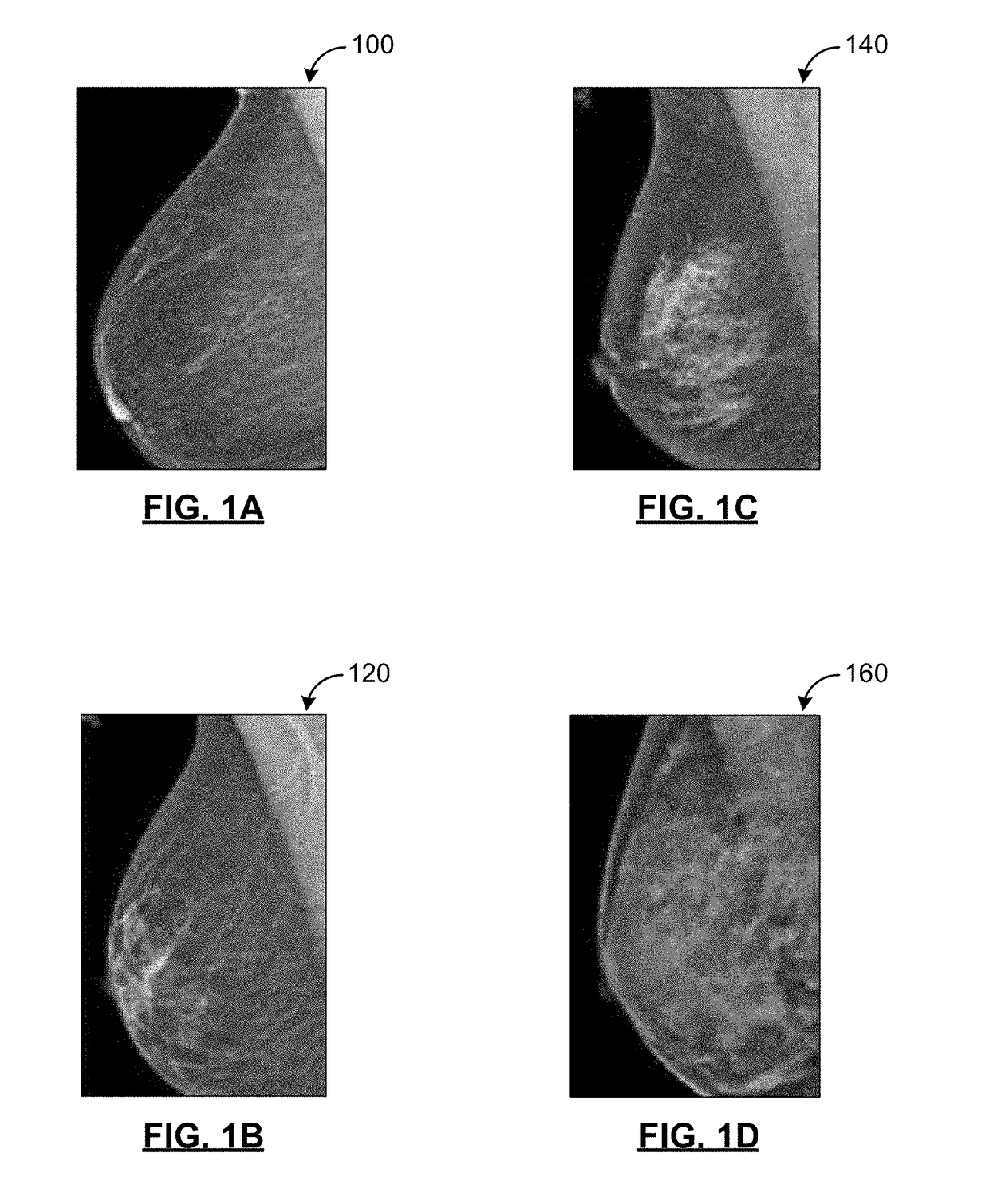 Methods and systems for determining breast density