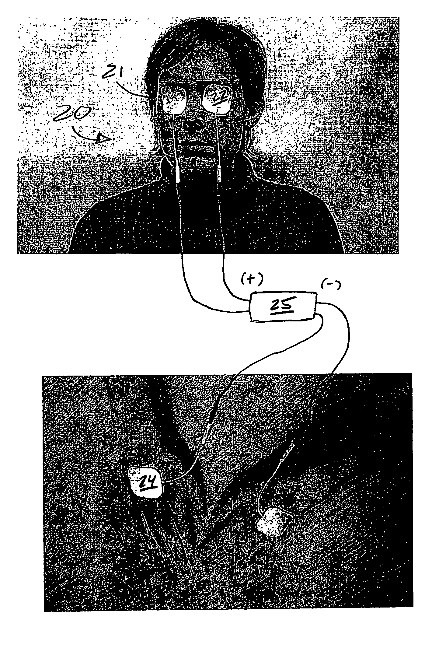 Treatment of vision disorders using electrical, light, and/or sound energy