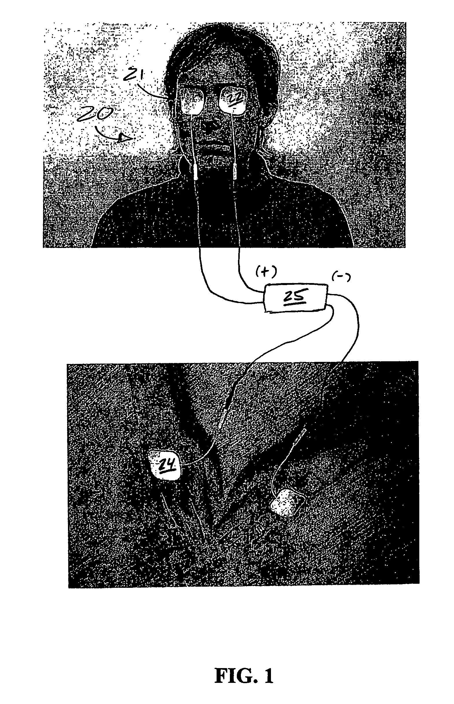 Treatment of vision disorders using electrical, light, and/or sound energy