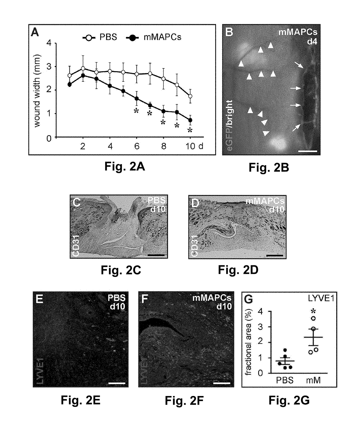 Stem cells for wound healing