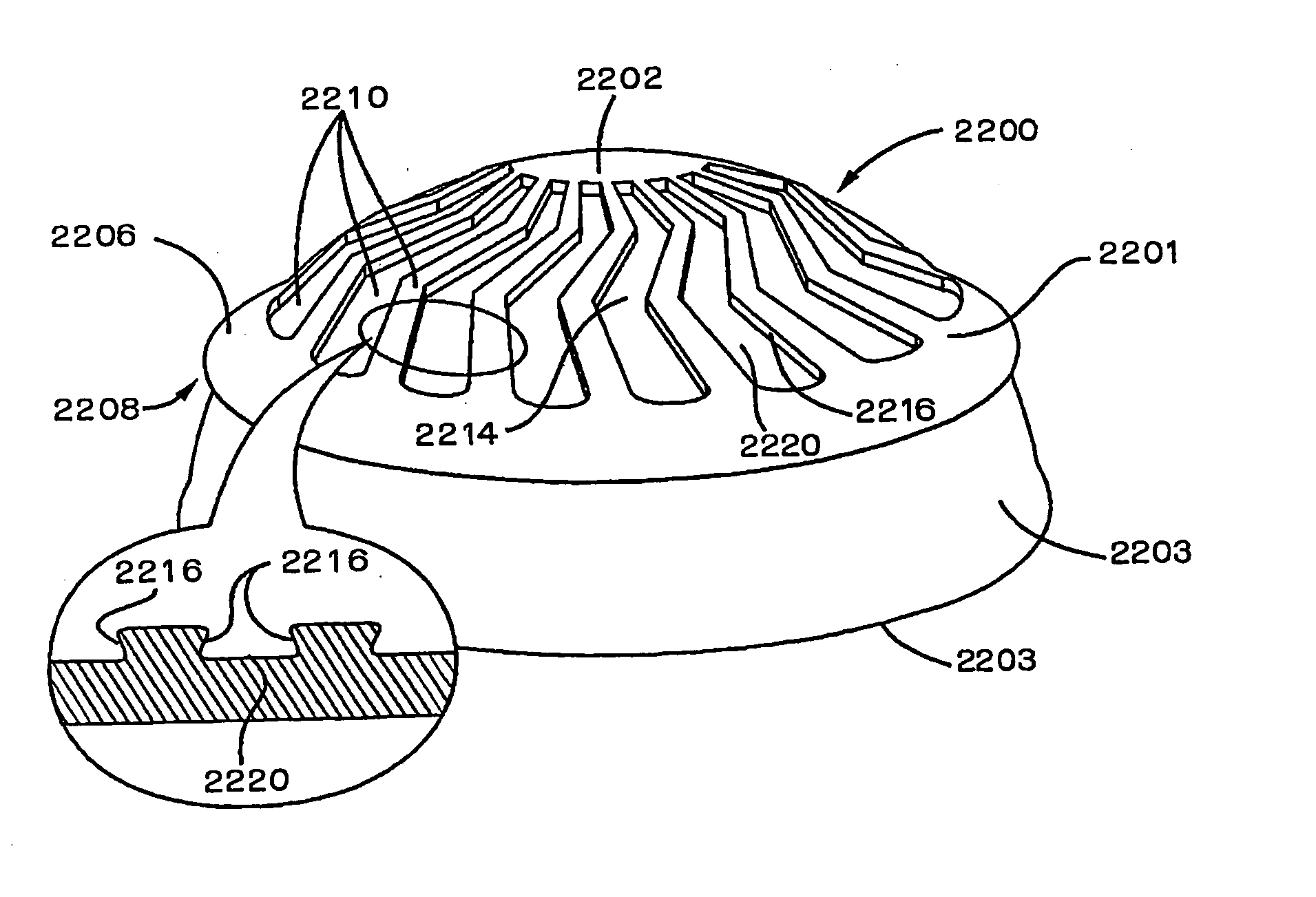 Implants