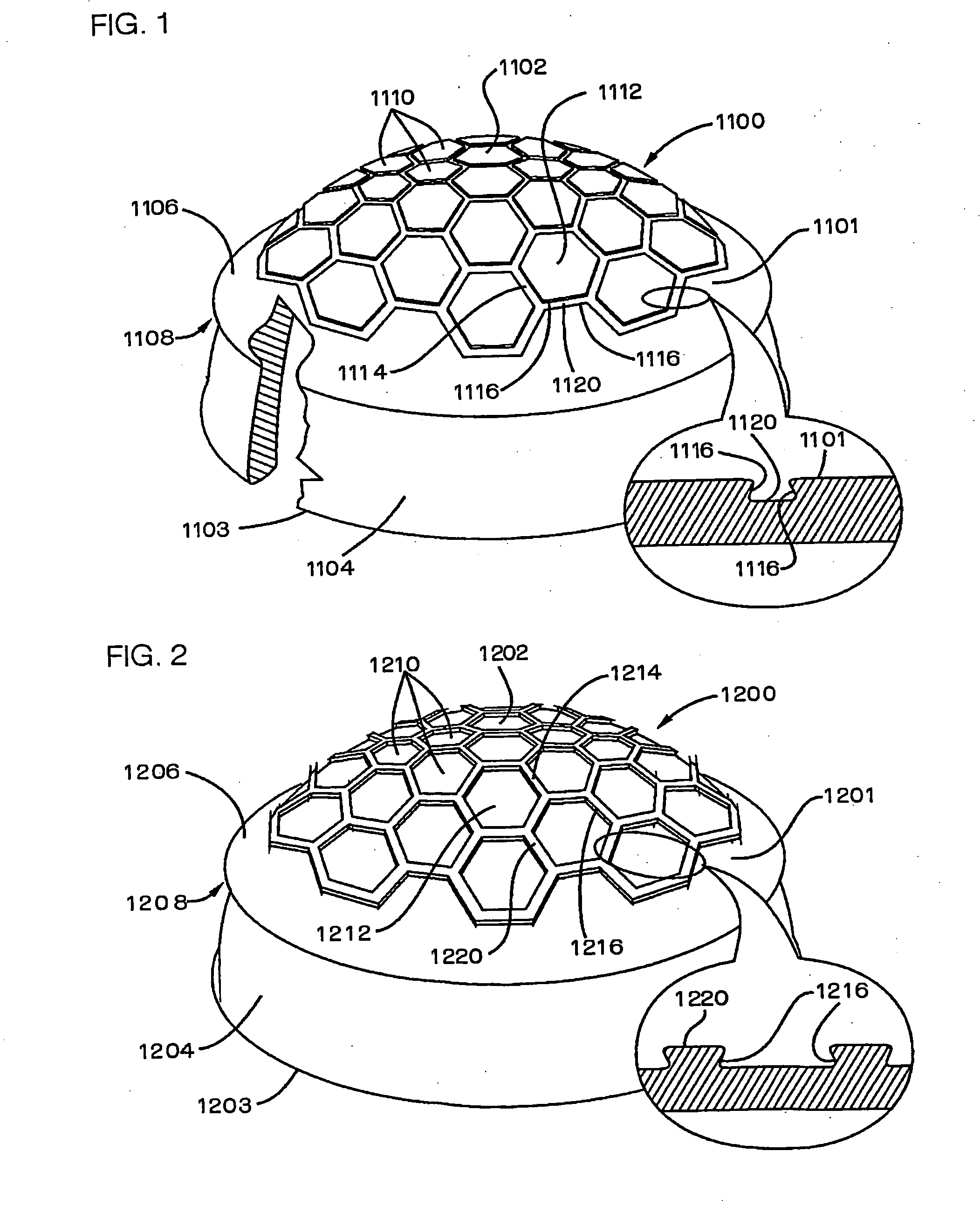 Implants