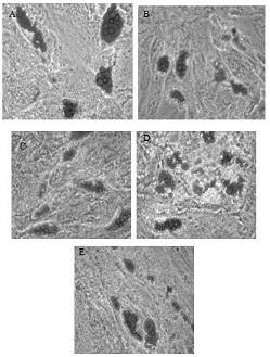 Serum-free polypeptide composition for promoting proliferation of mesenchymal stem cells