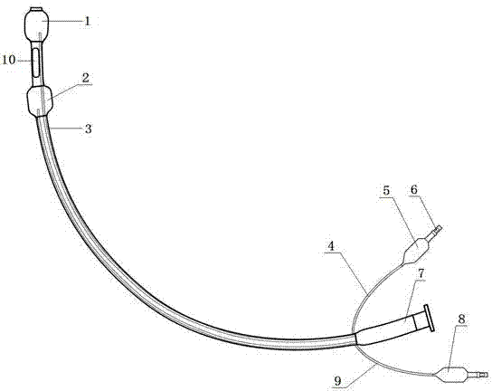 Visible sacculus sleeve for esophageal and gastric varices