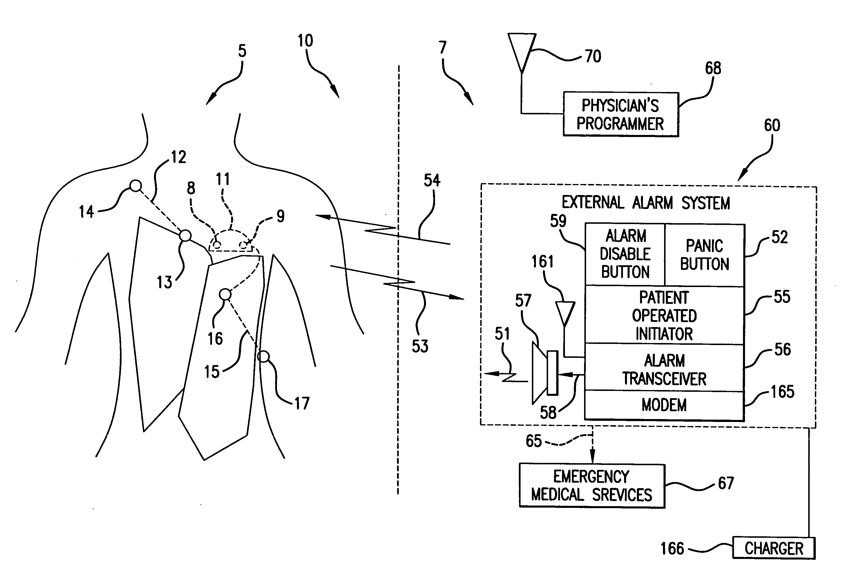 Waveform feature value averaging system and methods for the detection of cardiac events