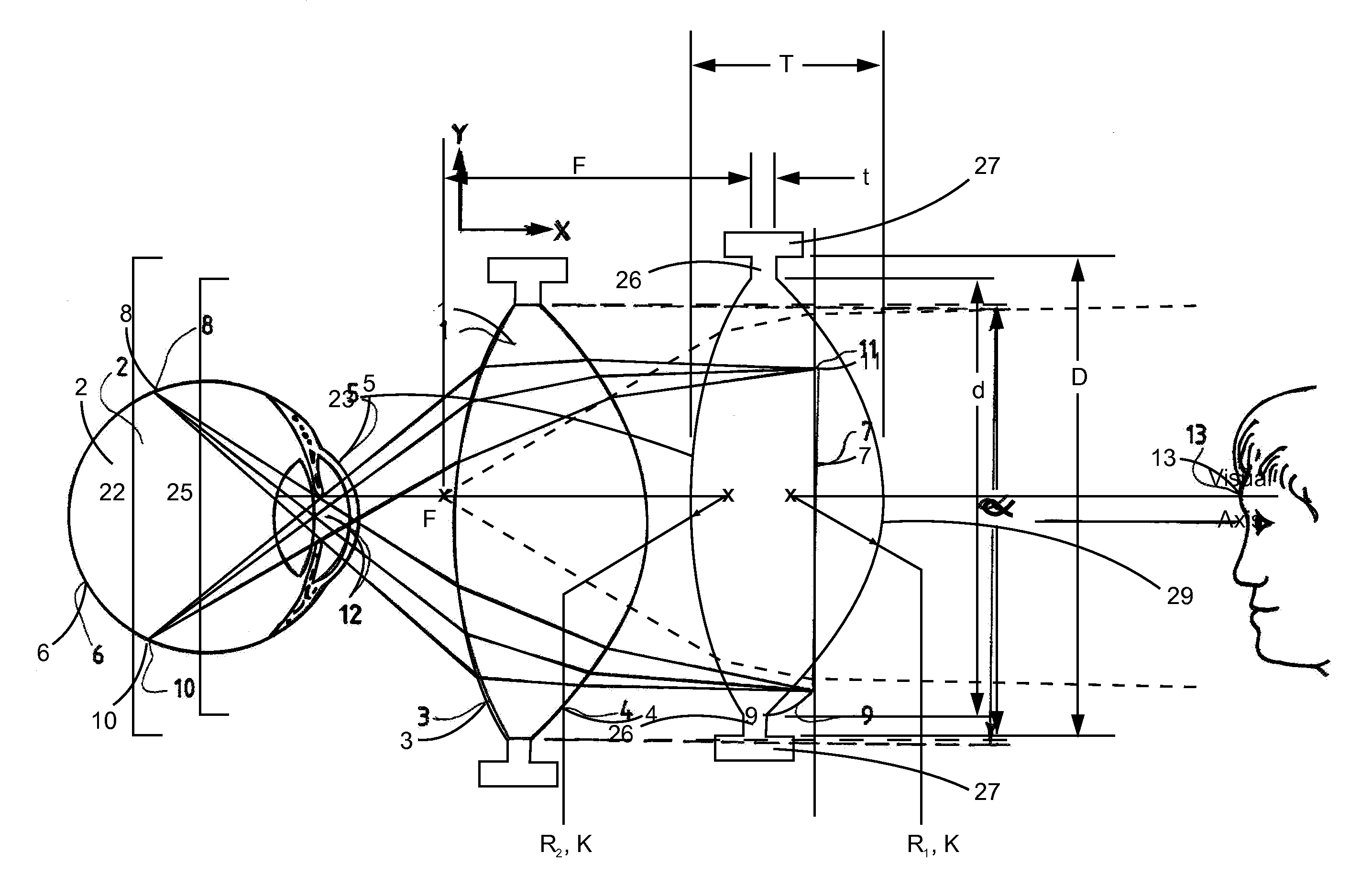 Molded Ophthalmic Lens