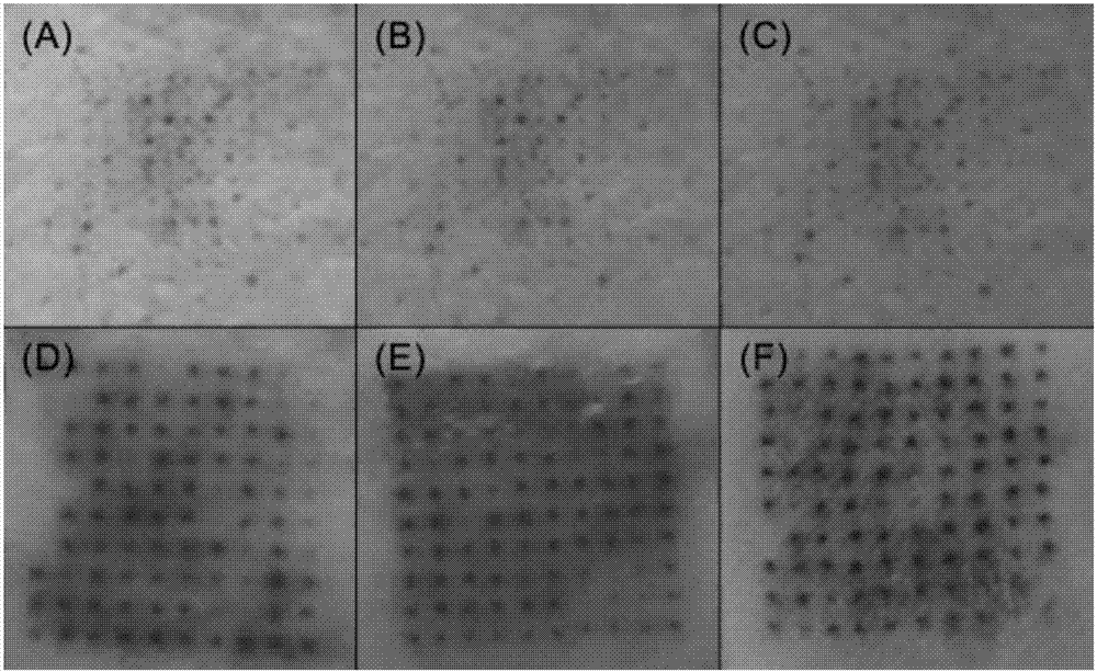 Soluble thymopentin microneedle and preparation method thereof