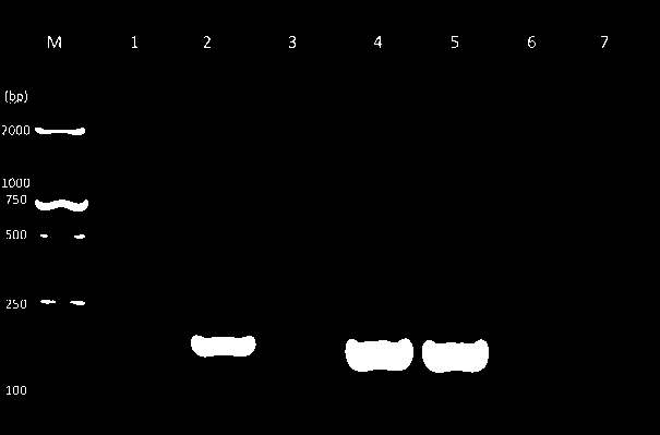 Kit for detecting non-mucus type klebsiella pneumoniae with high virulence