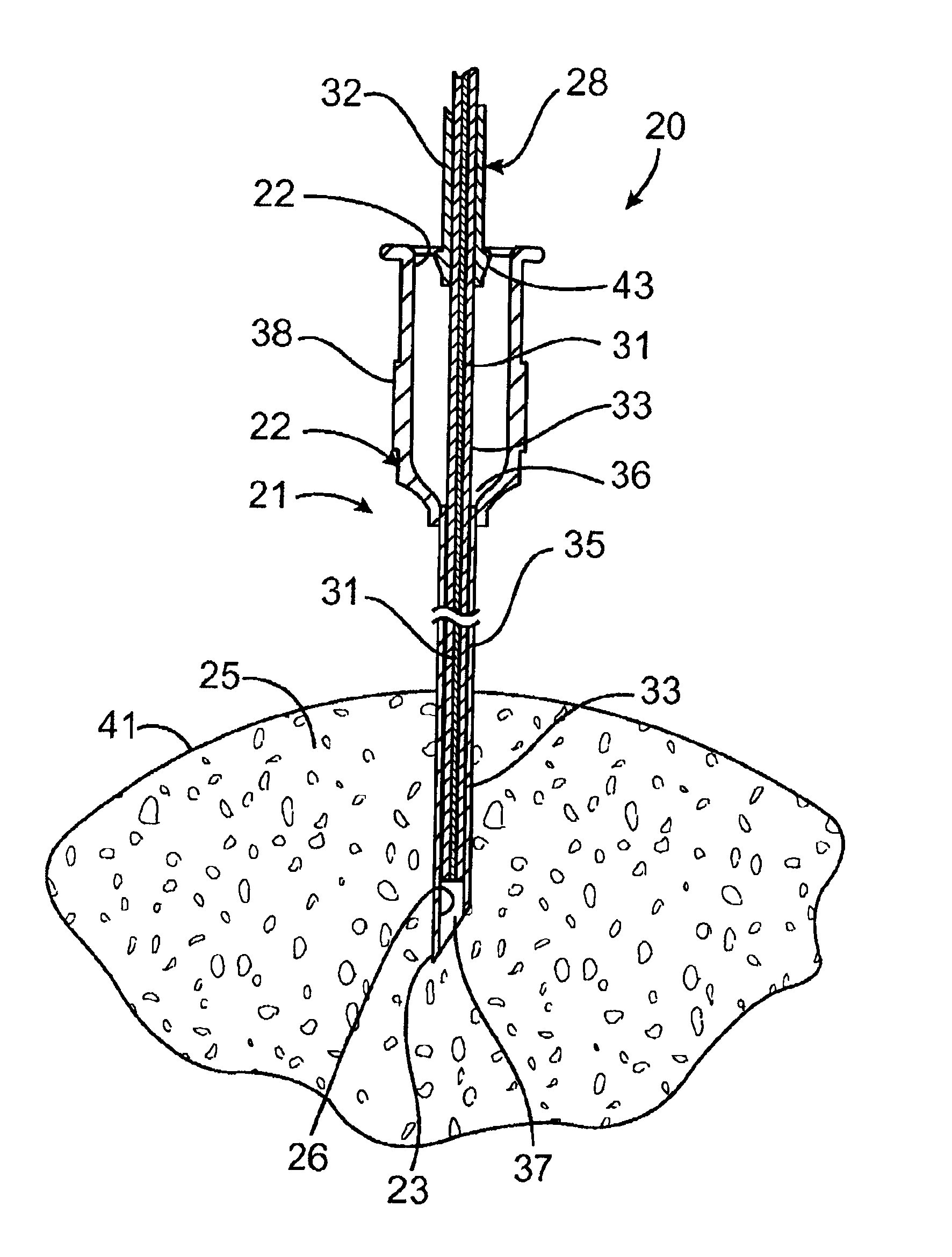 Microwave ablation instrument with insertion probe