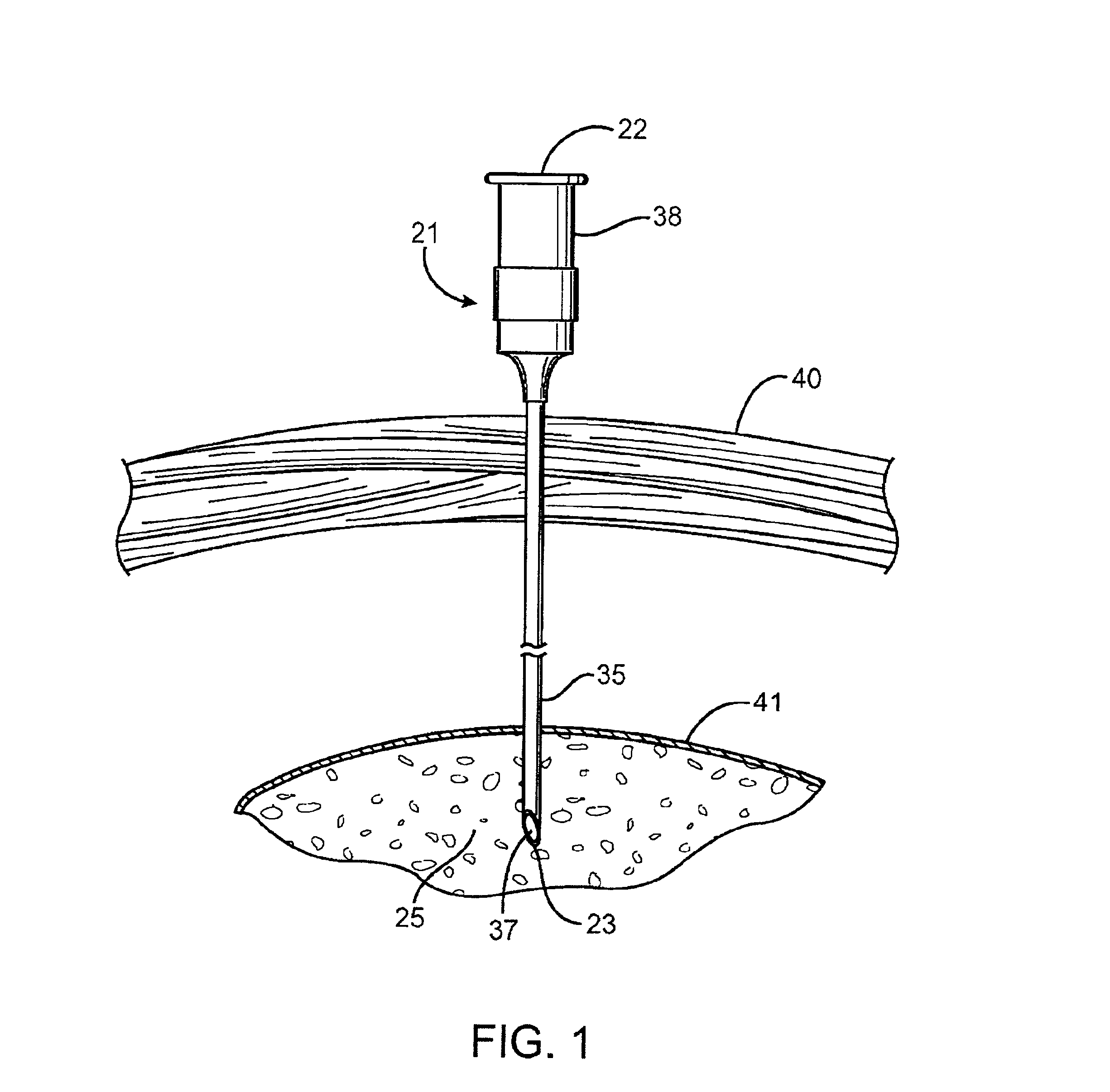 Microwave ablation instrument with insertion probe