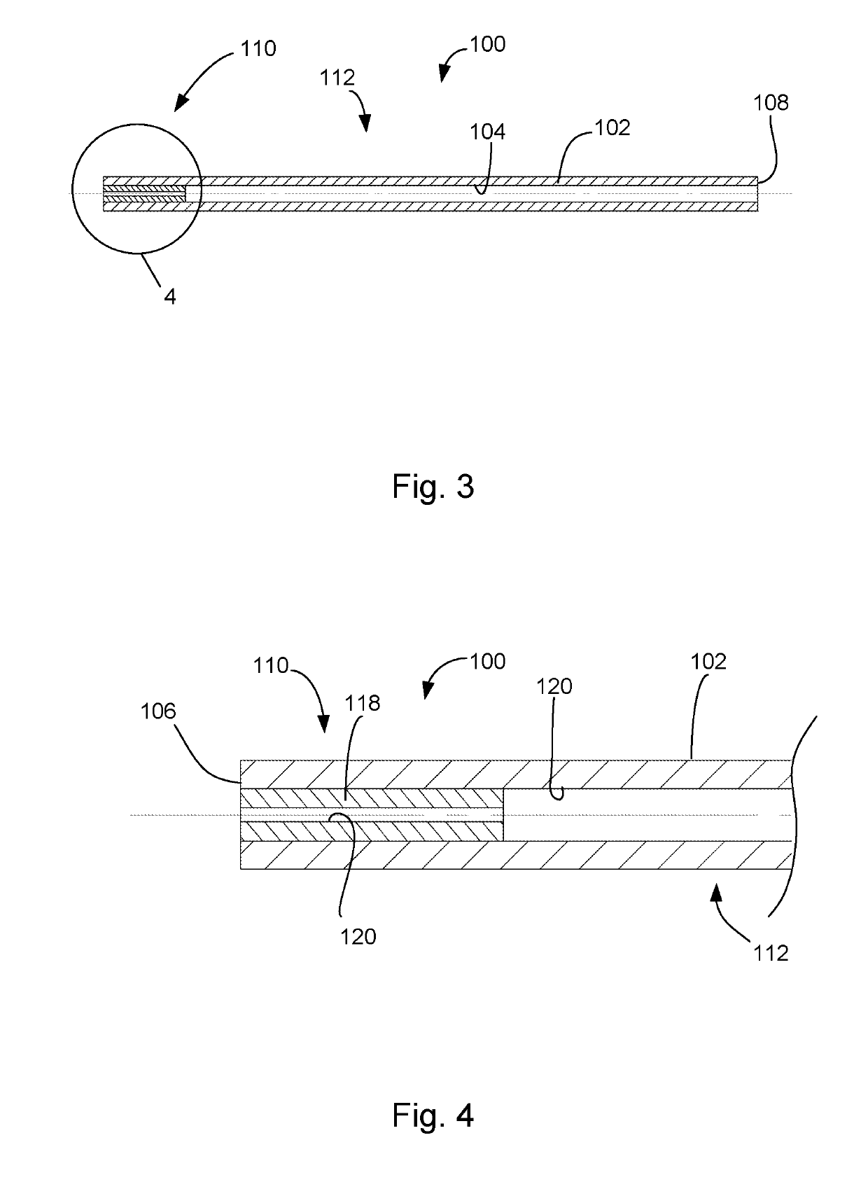 Adjustable intraocular implant