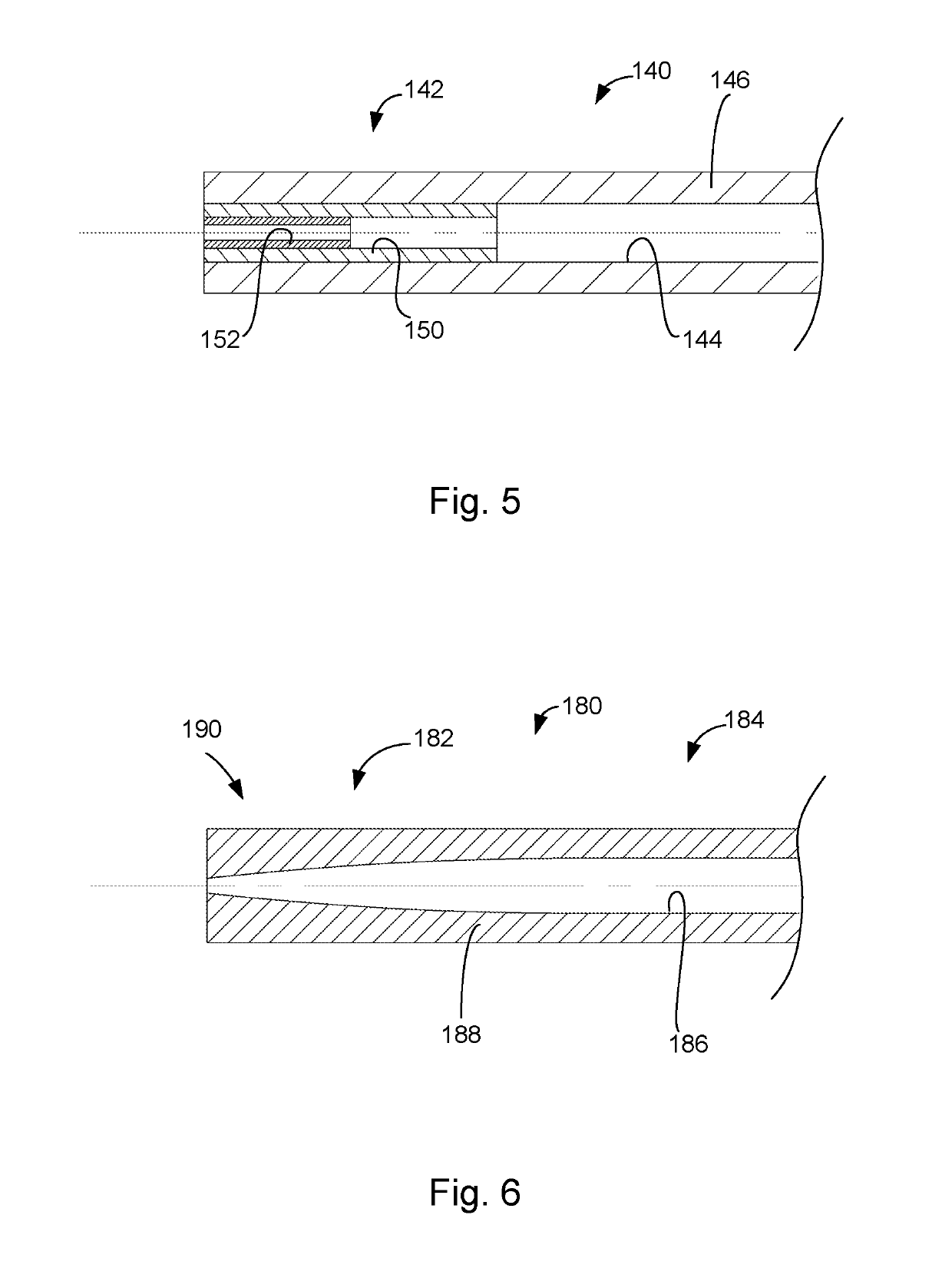 Adjustable intraocular implant