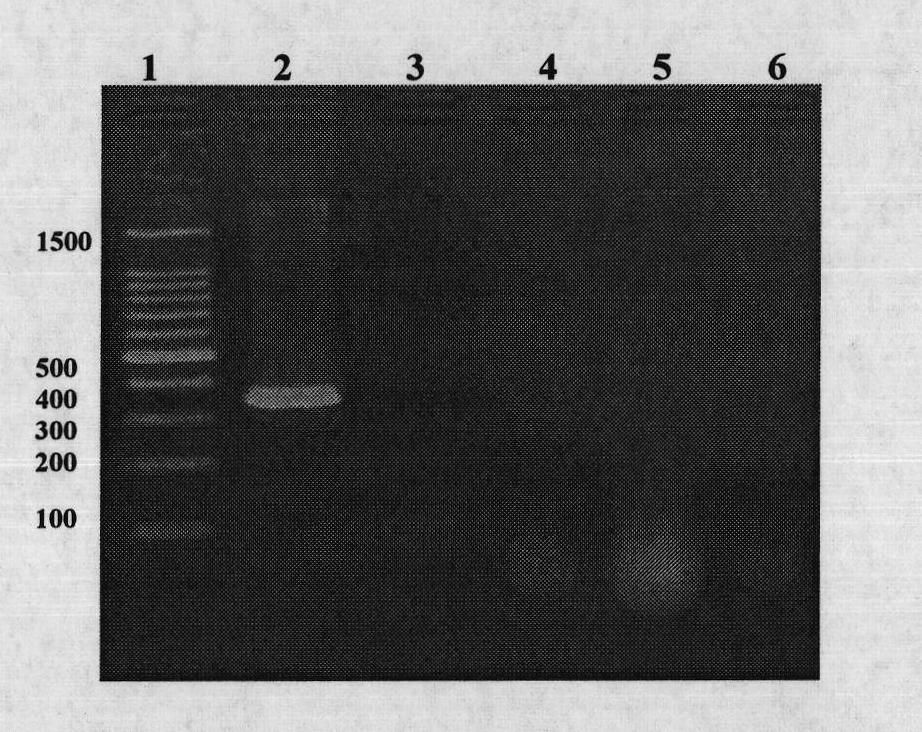 PCR (Polymerase Chain Reaction) and fluorescent PCR rapid detection method of bee sacbrood diseases