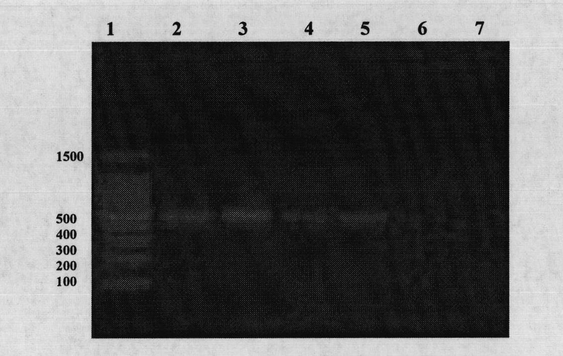 PCR (Polymerase Chain Reaction) and fluorescent PCR rapid detection method of bee sacbrood diseases