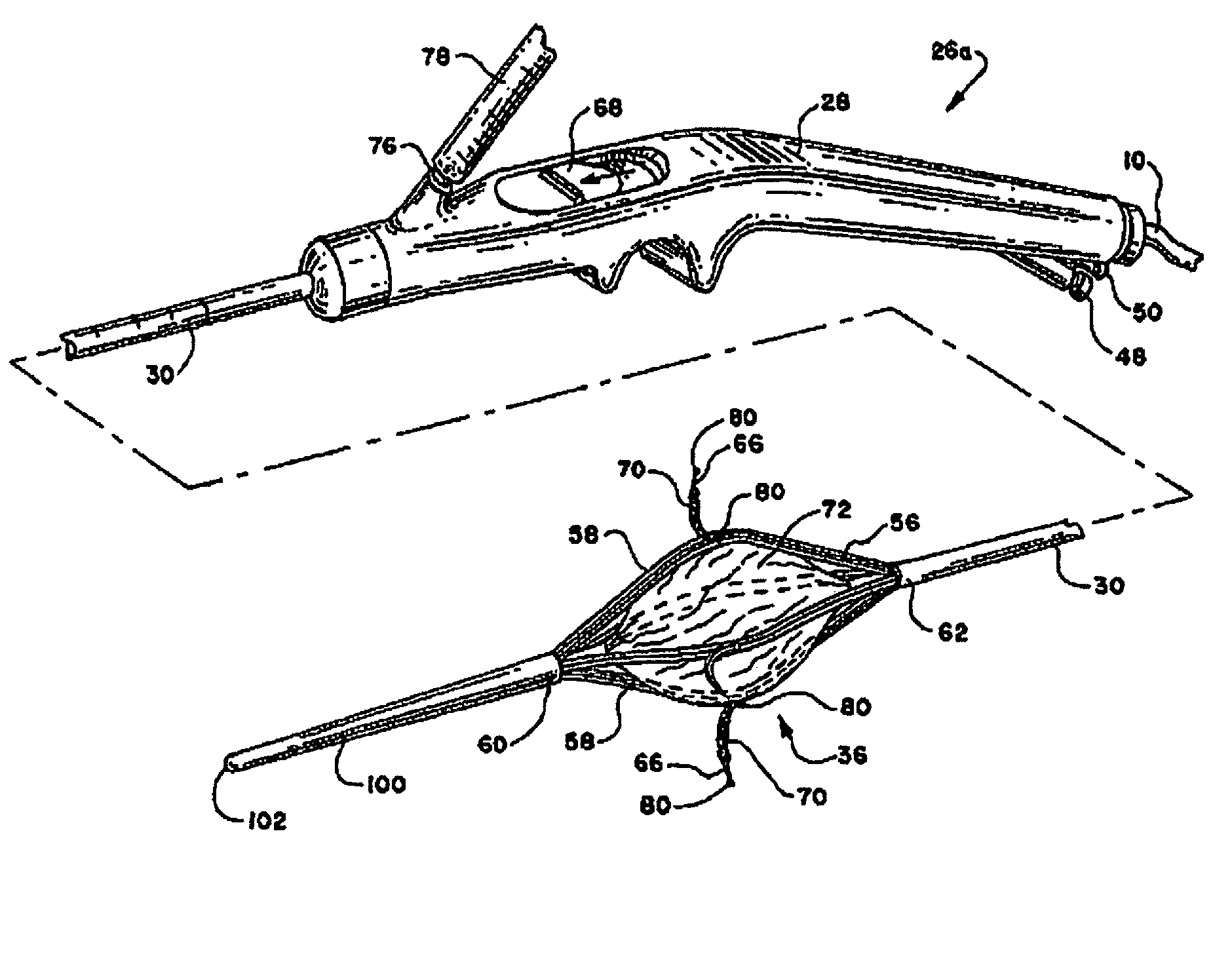 Systems and methods for treating tissue with radiofrequency energy