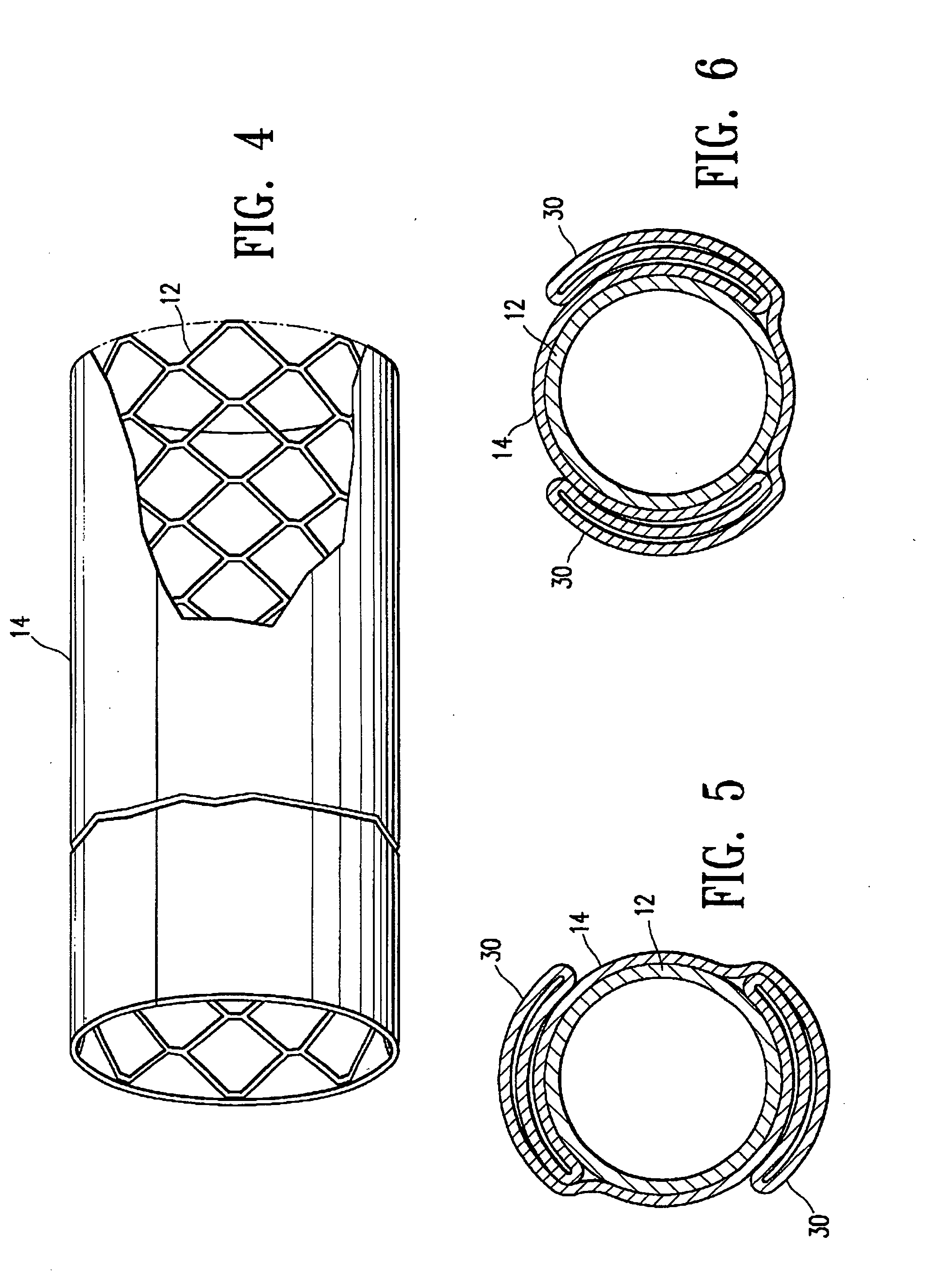 Non-thrombogenic stent jacket