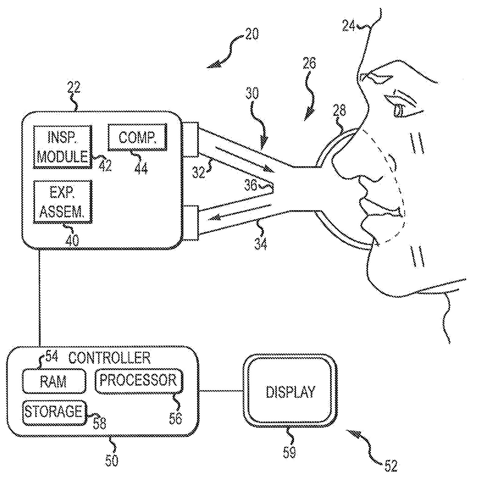 Exhalation Valve Assembly