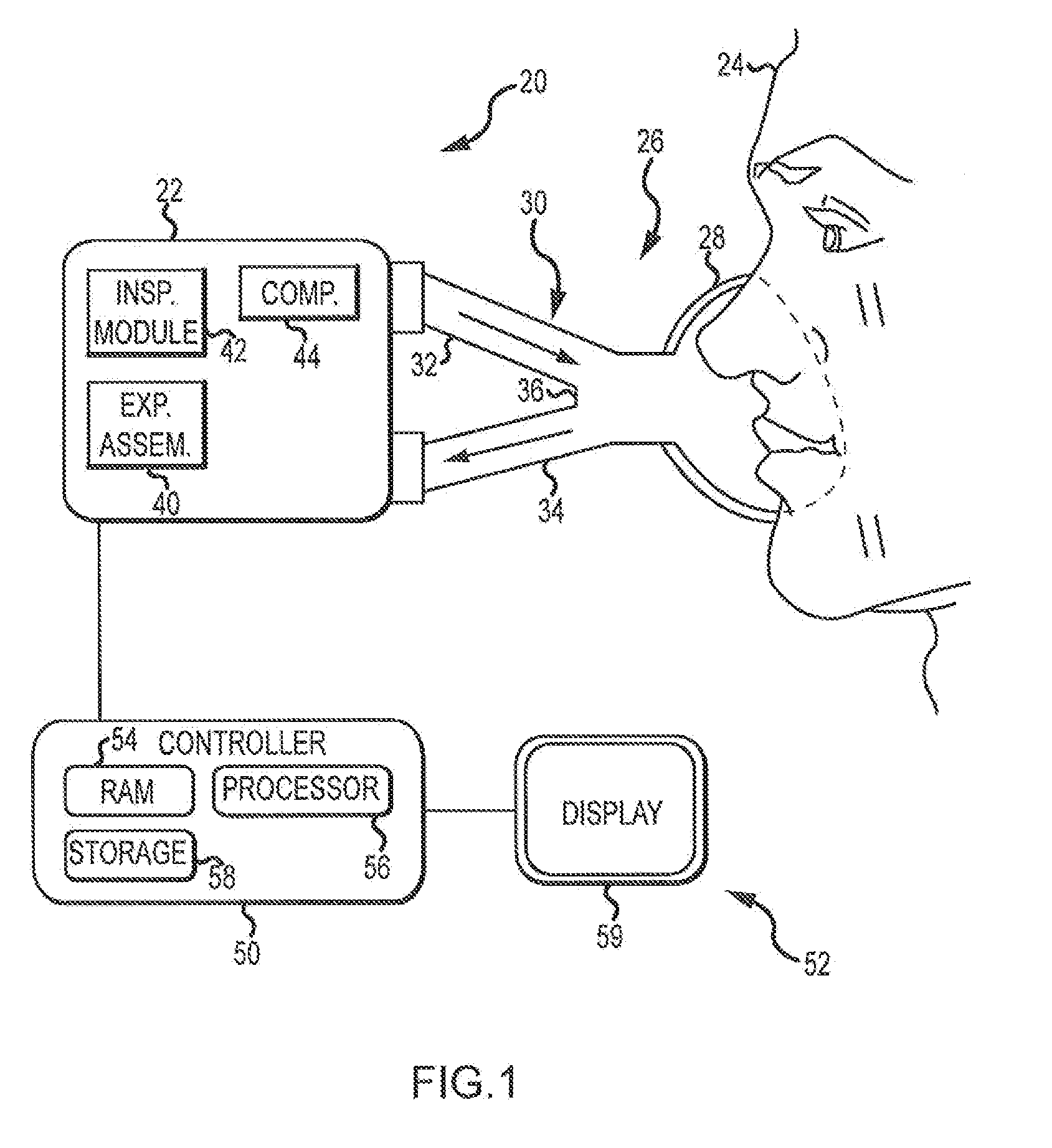 Exhalation Valve Assembly