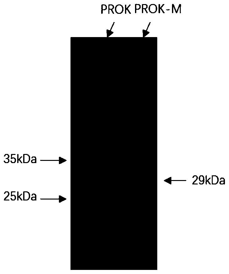 Alkaline protease mutant PROK-M with increased specific activity and thermal stability, and coding gene and applications thereof