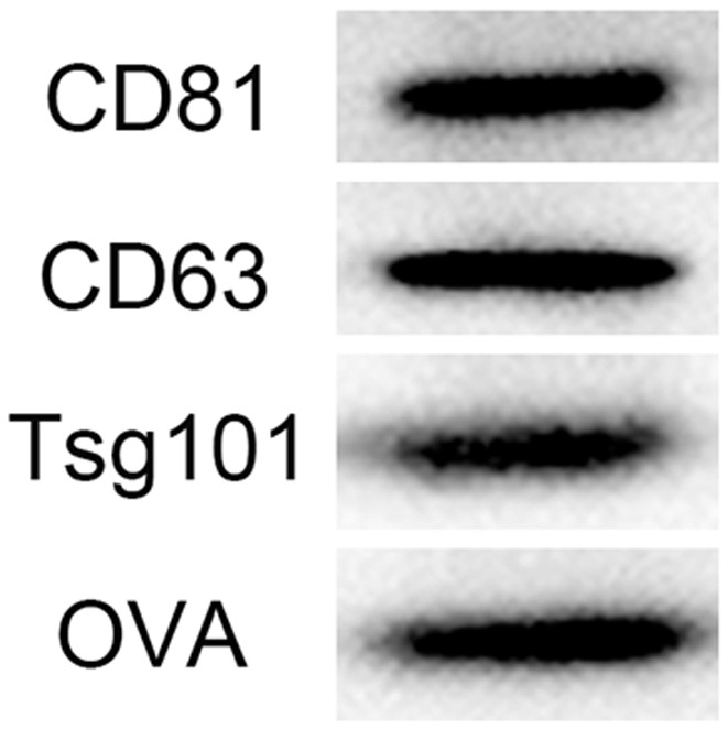 A kind of m1 macrophage exosome vaccine and its preparation method and application