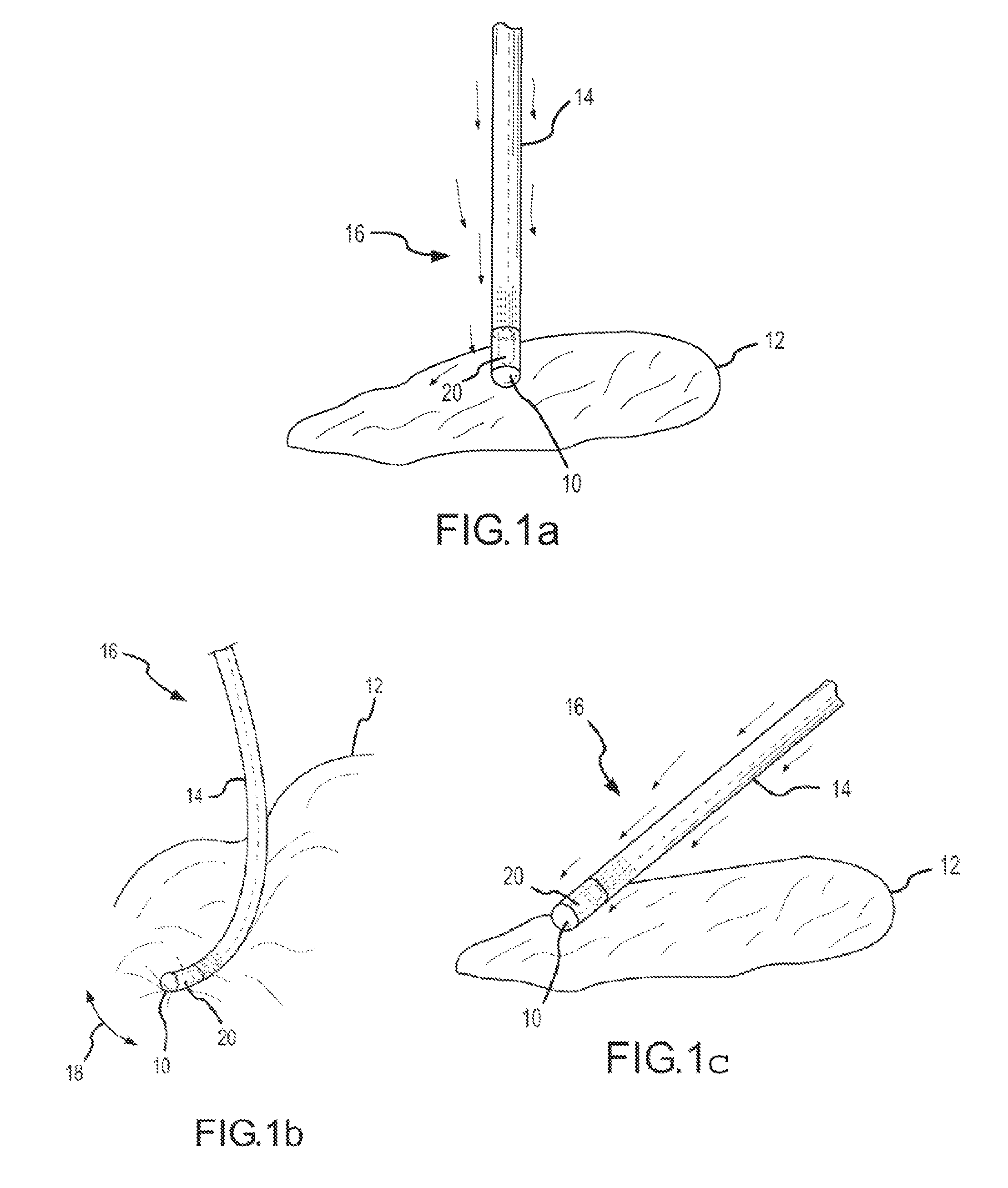 Systems and methods for assessing tissue contact