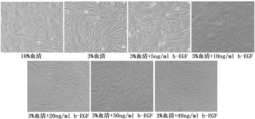 Sheep fetal skin fibroblast and separation method and application thereof