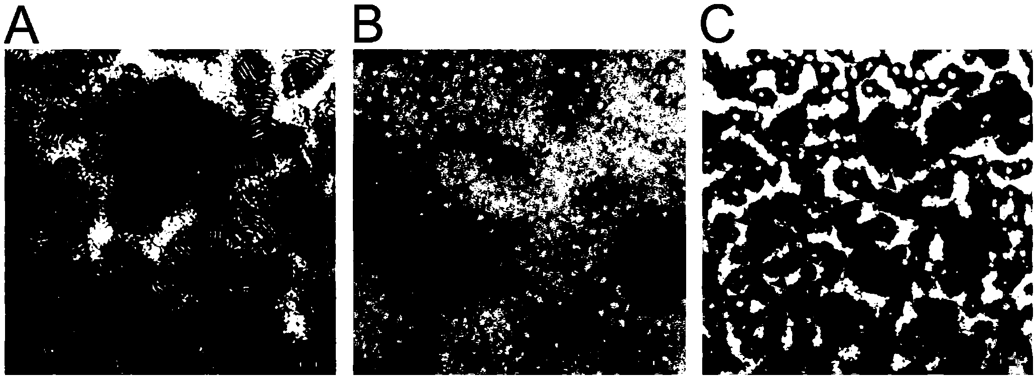 A beta targeted recombinant lipoprotein nano drug carrier and preparation method and application thereof