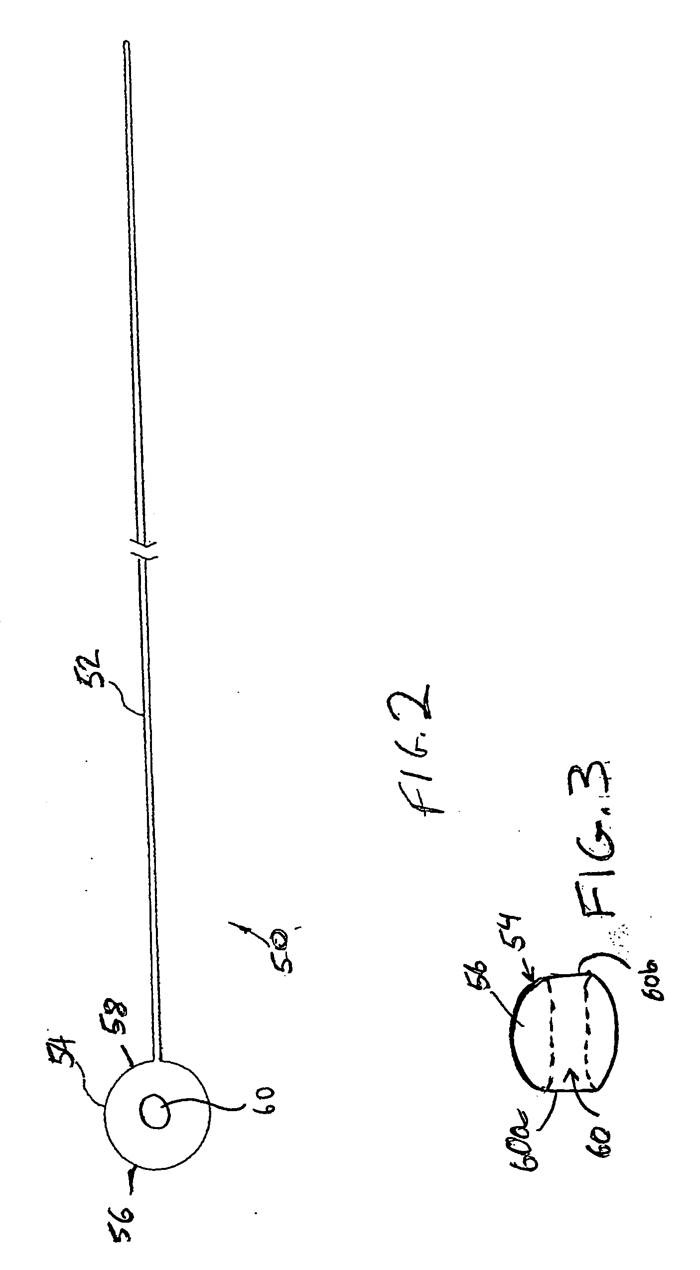 Tubular apparatus for drainage of the colon and method and guidewire for colonic intubation