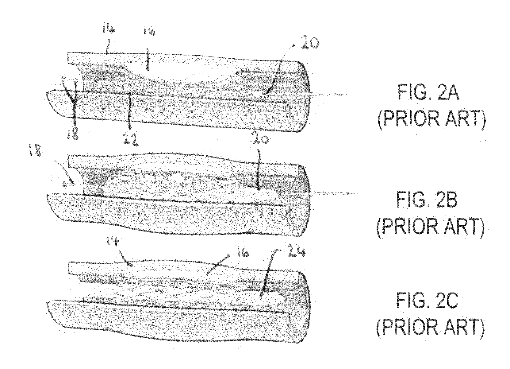 Flexible stent with elevated scaffolding properties