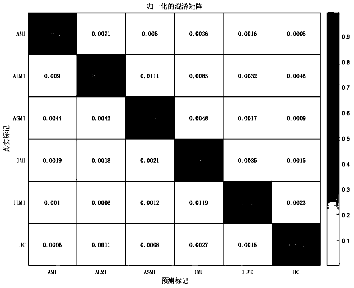 Acute myocardial infarction positioning method based on GA-ELM (genetic algorithm-extreme learning machine) mixed model