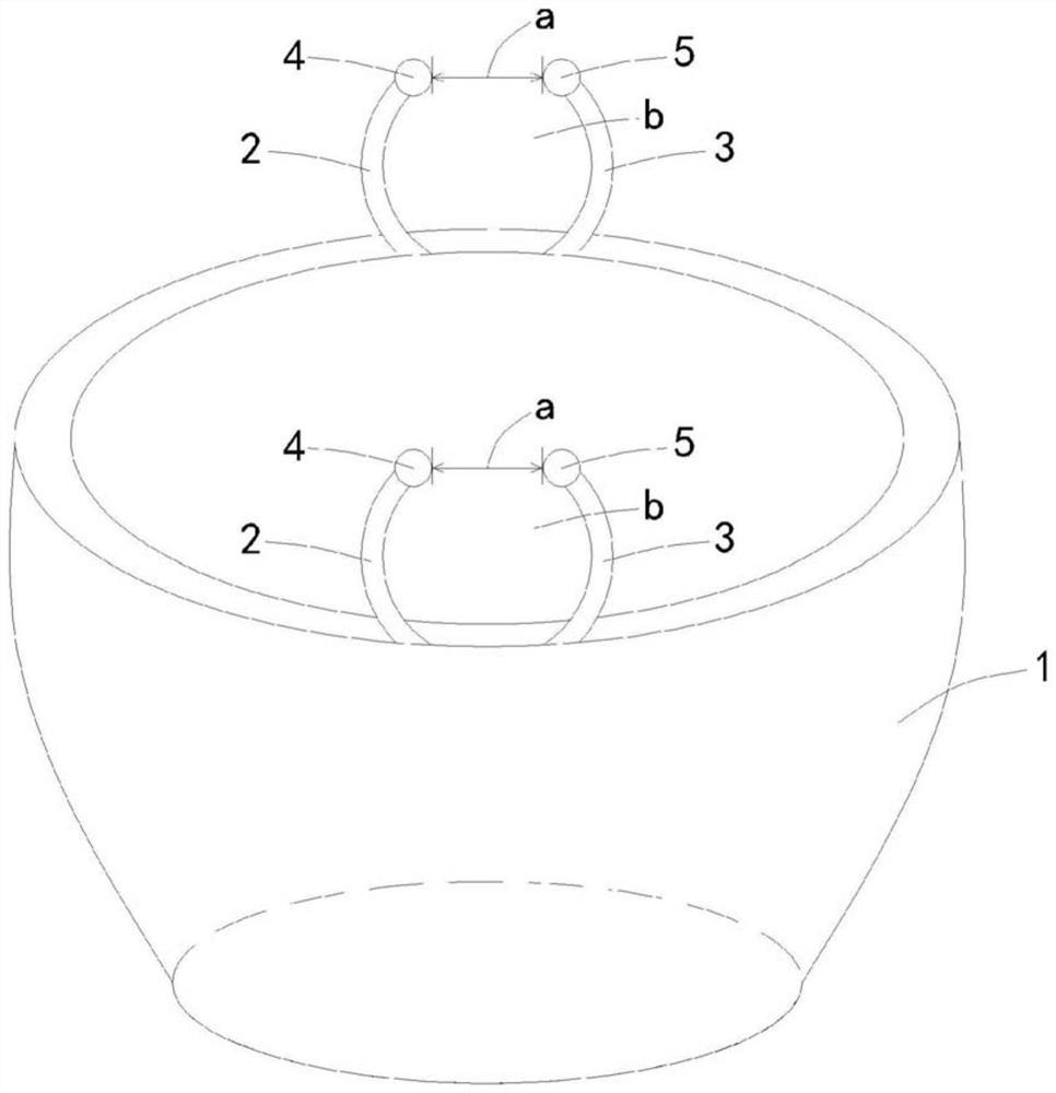 Special treatment bowl for replacing peritoneal dialysis catheter