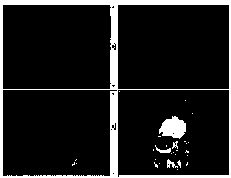 Method for manufacturing skull defect repair prosthesis