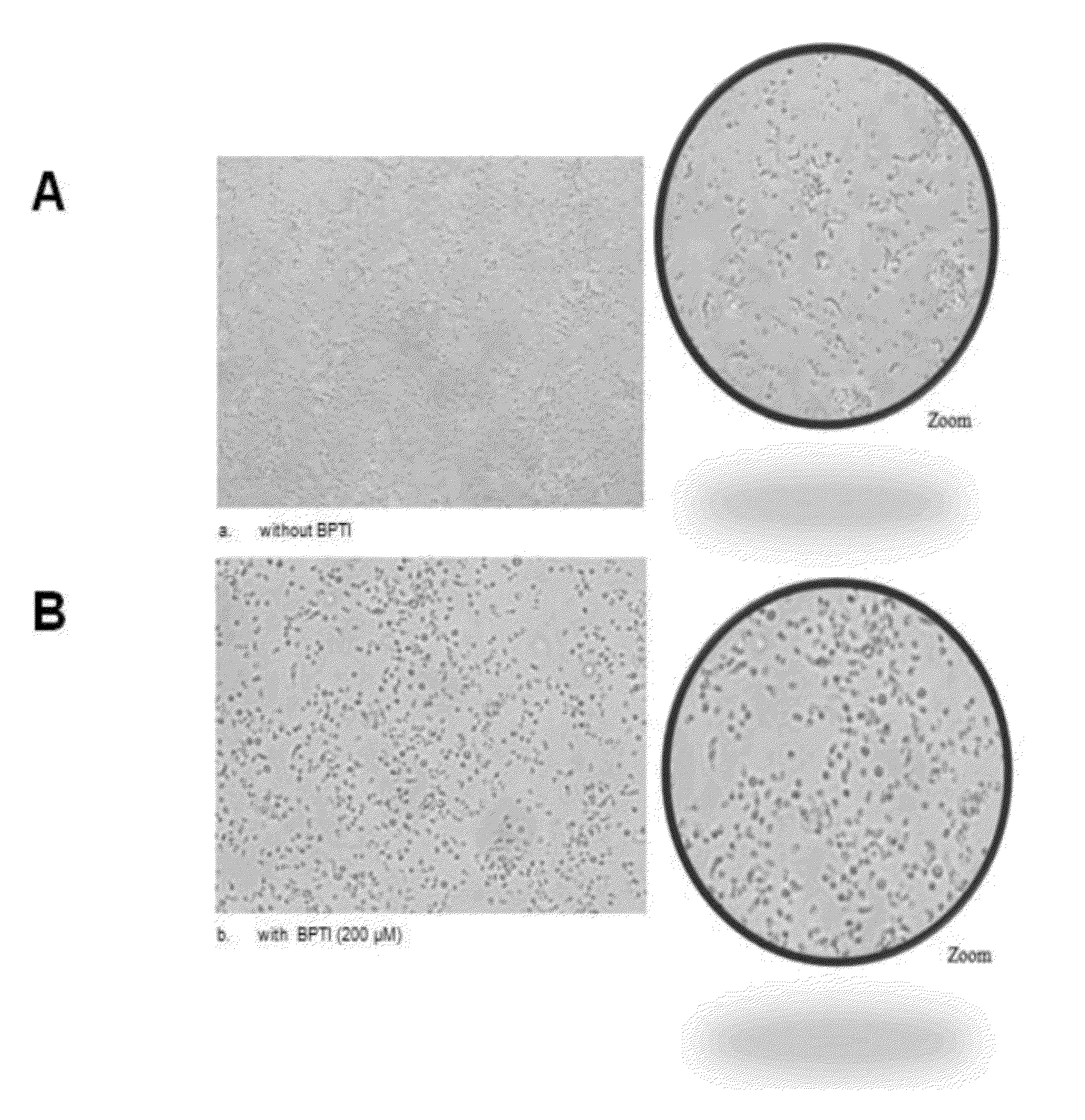 Use of aprotinin for treating parasitic infections and prognosing bovine trypanotolerance